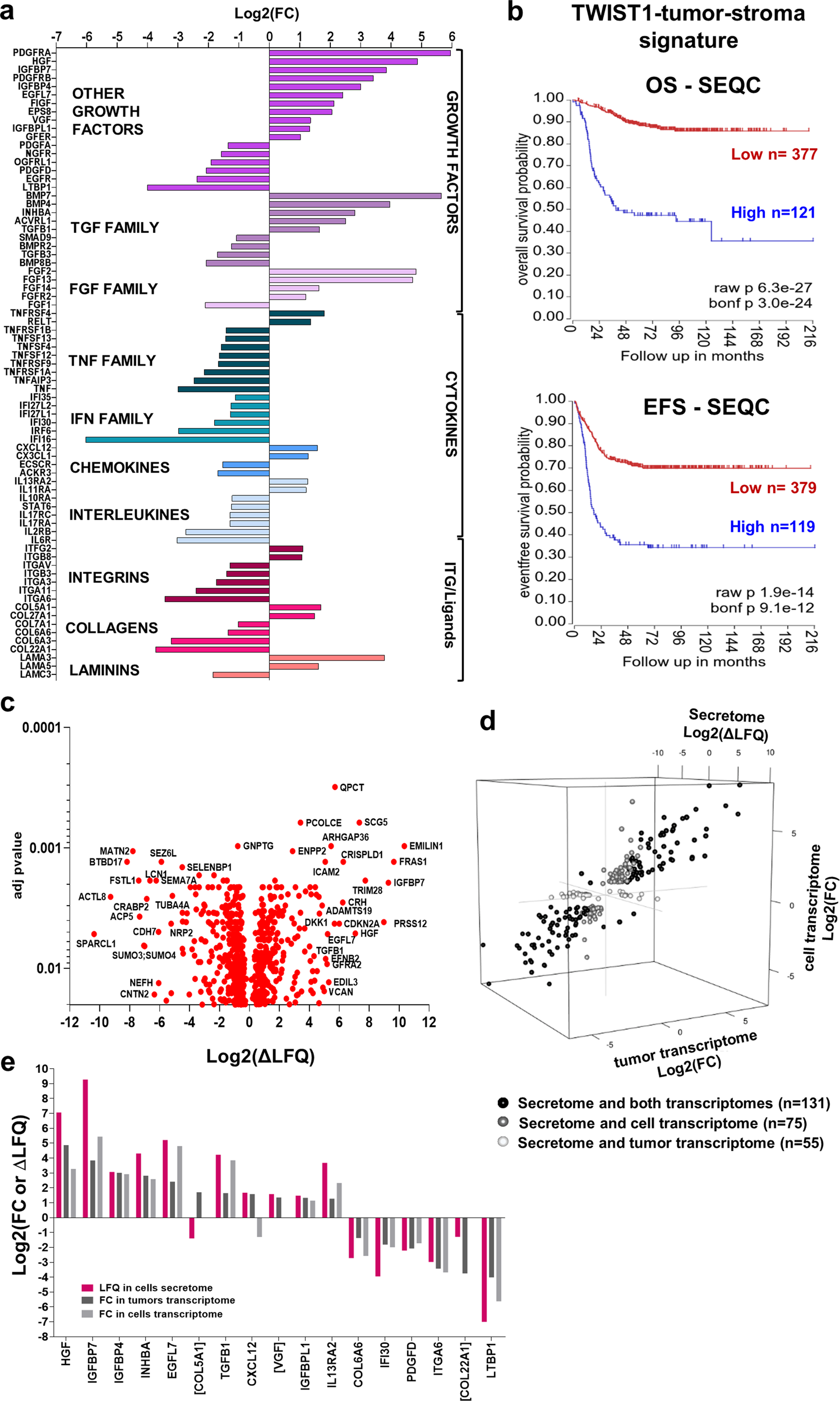 Fig. 7: Identification of a TWIST1-mediated-tumor-stroma signature associated with poor outcome in NB.