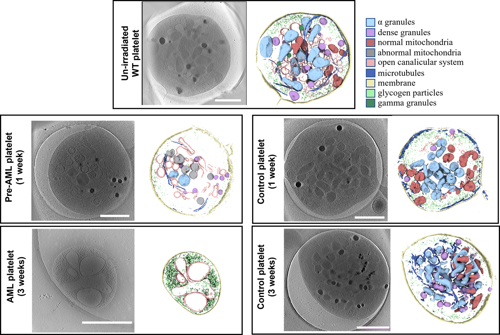 Fig. 1: Cryo-ET of platelets from mice in different states.
