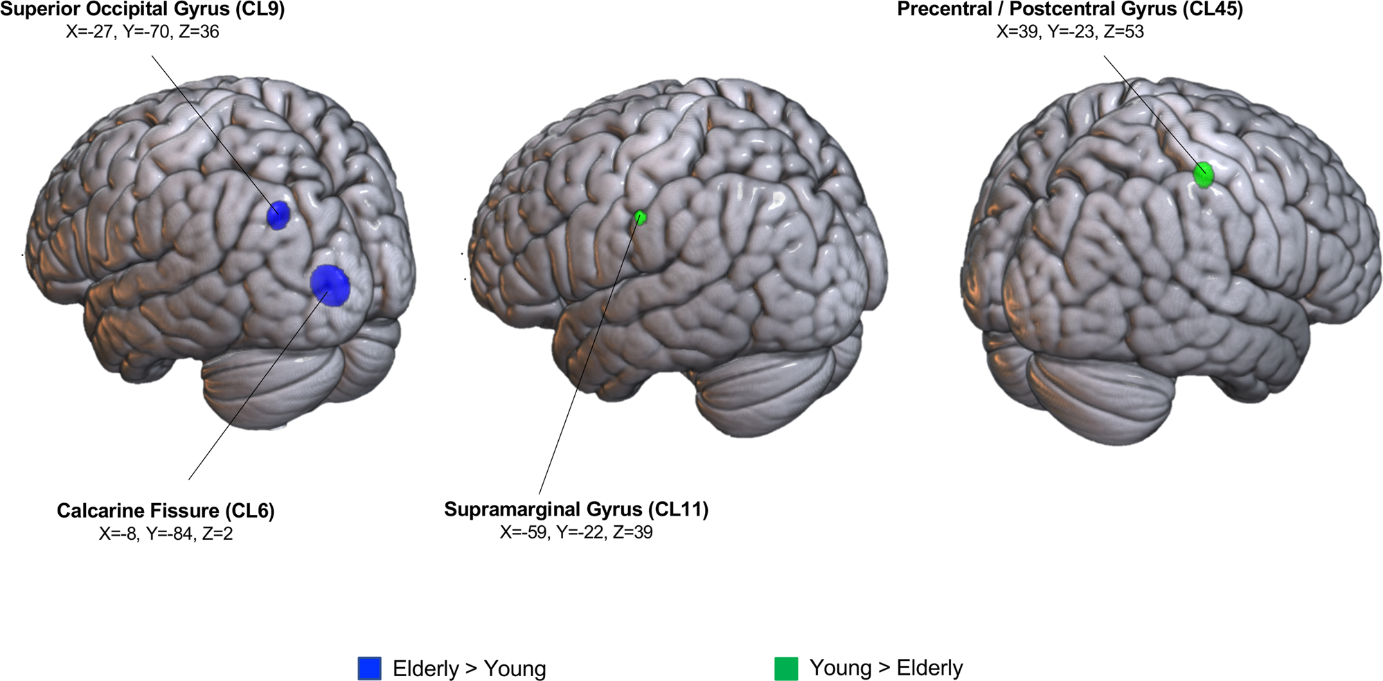 Free Online Memory Test Evaluates Brain Health Status in Persons Over 50