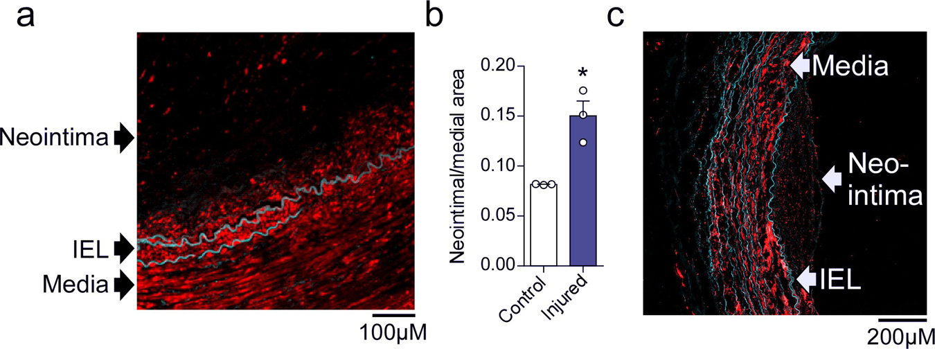 Fig. 5: sGCβ1 expression is reduced in the neointima of diseased and injured human arteries.