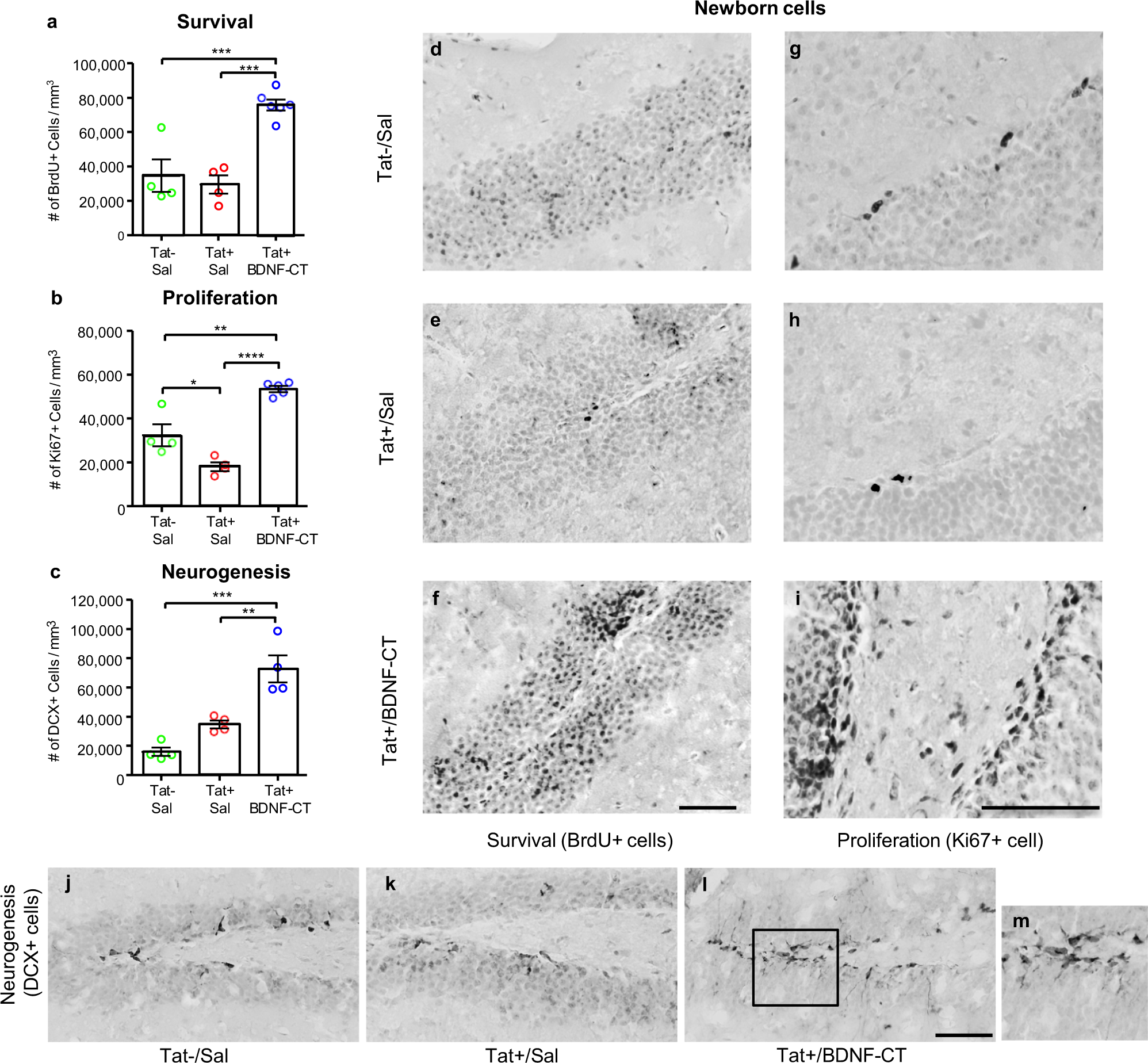 Fig. 4: BDNF-CT increased newborn cell survival, proliferation, and neurogenesis.