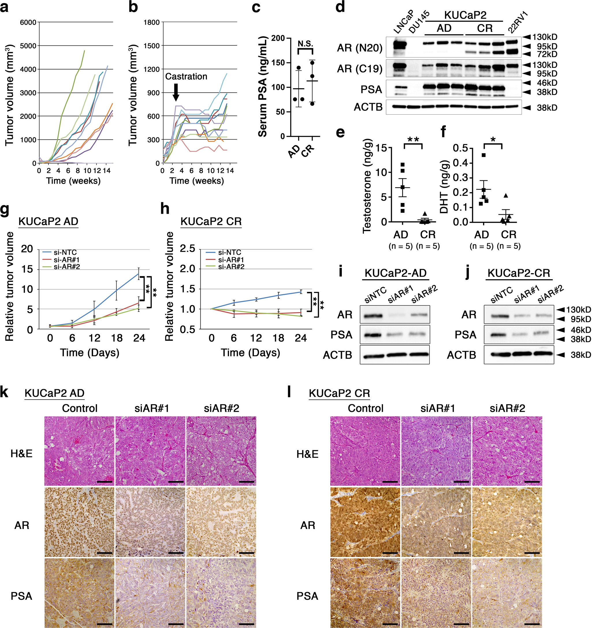 Comprehensive genomics in androgen receptor-dependent castration-resistant  prostate cancer identifies an adaptation pathway mediated by opioid  receptor kappa 1 | Communications Biology
