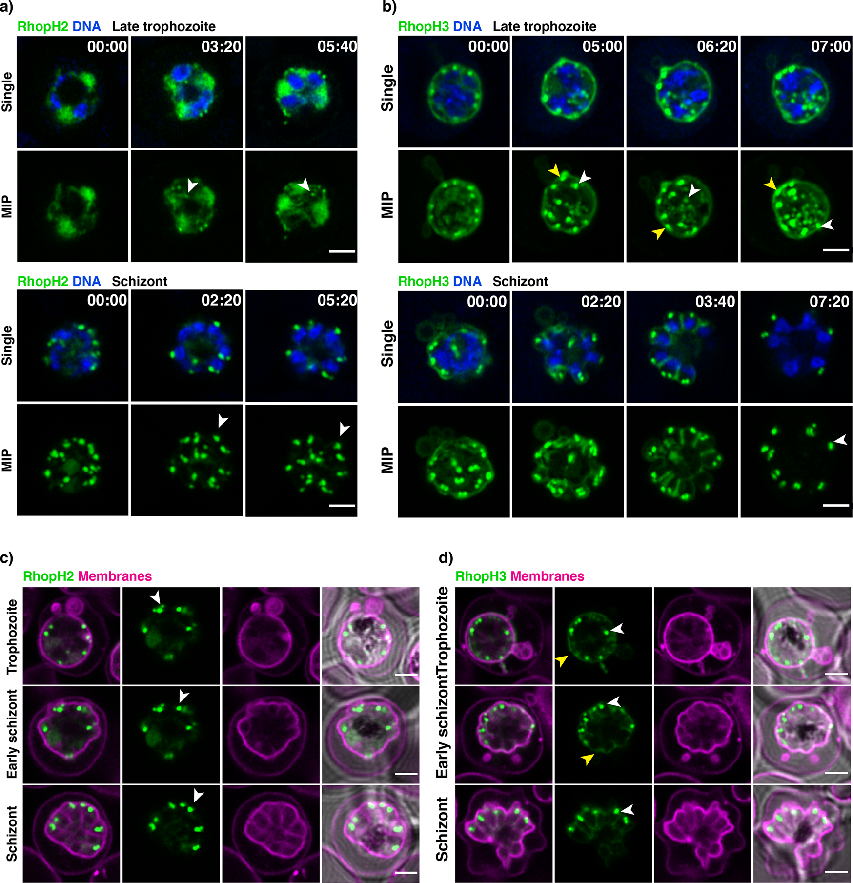 RhopH2 and RhopH3 export enables assembly of the RhopH complex on P.  falciparum-infected erythrocyte membranes | Communications Biology