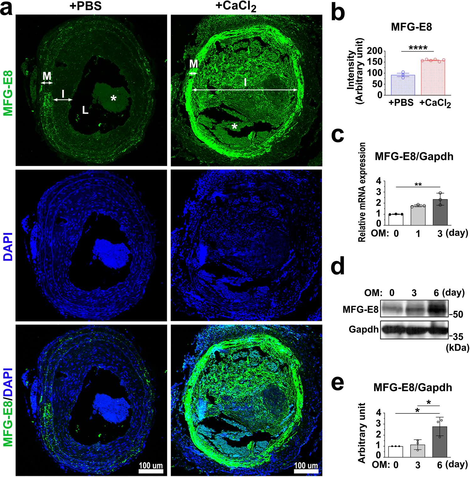 MFG-E8 promotes osteogenic transdifferentiation of smooth muscle cells and  vascular calcification by regulating TGF-β1 signaling | Communications  Biology
