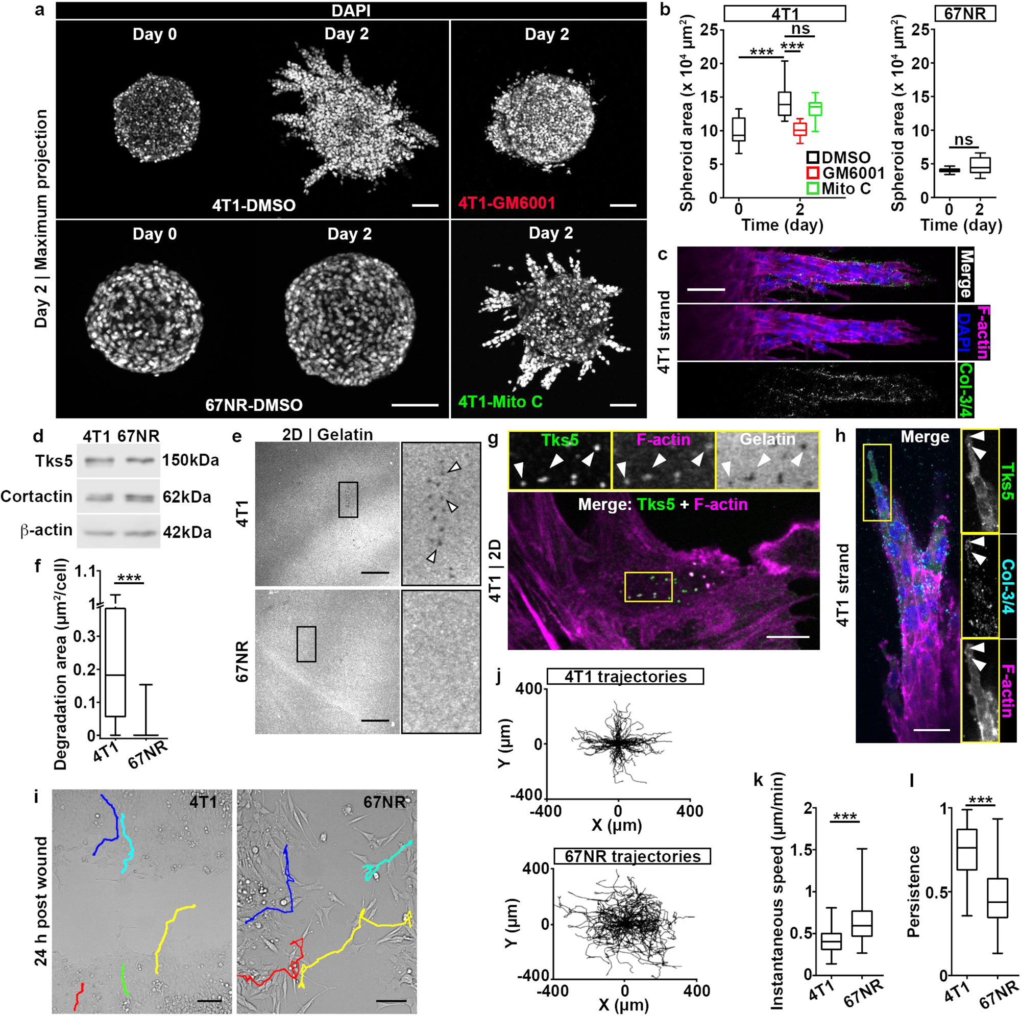 Invadopodia enable cooperative invasion and metastasis of breast cancer  cells | Communications Biology