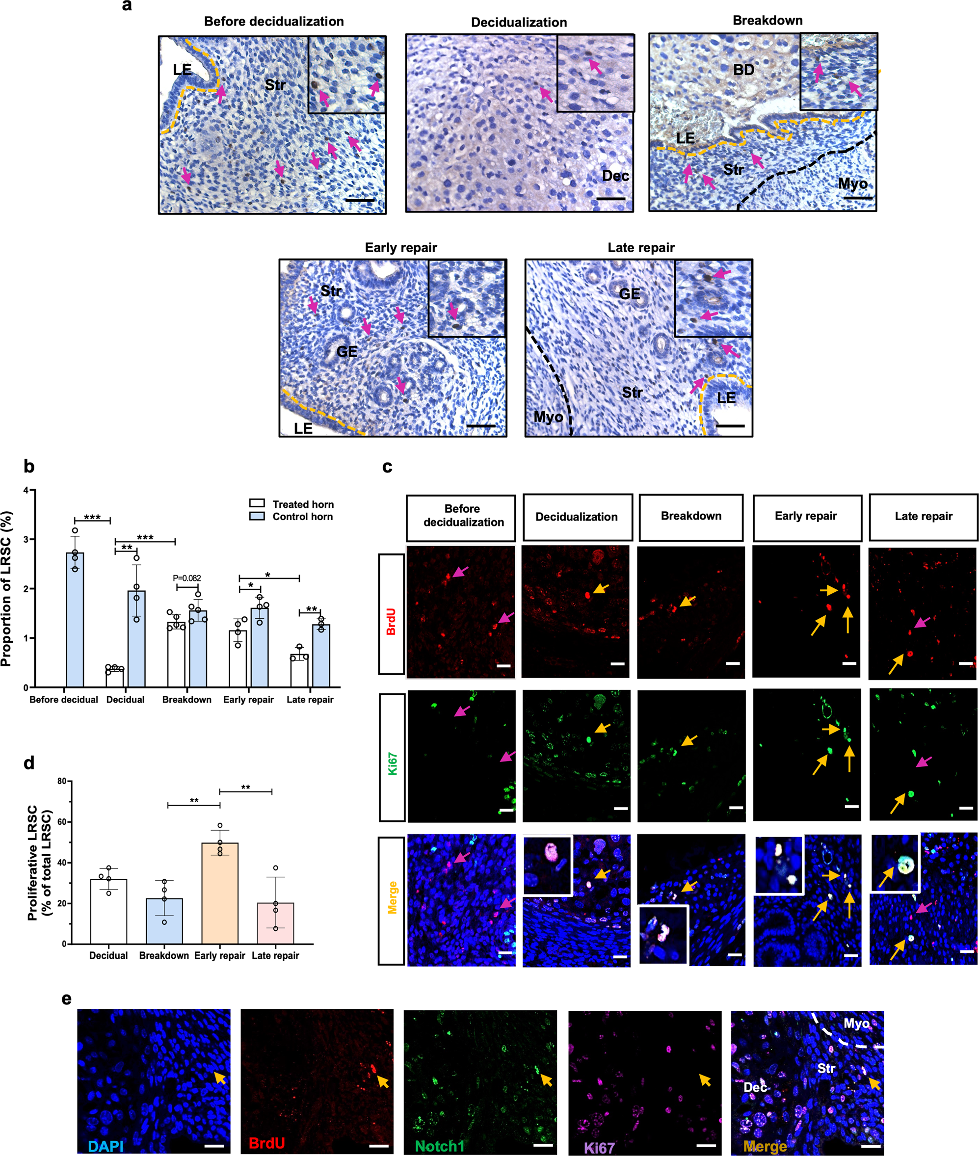 Fig. 5: Localization of BrdU-labeled stromal cells in the mouse menstrual-like model.