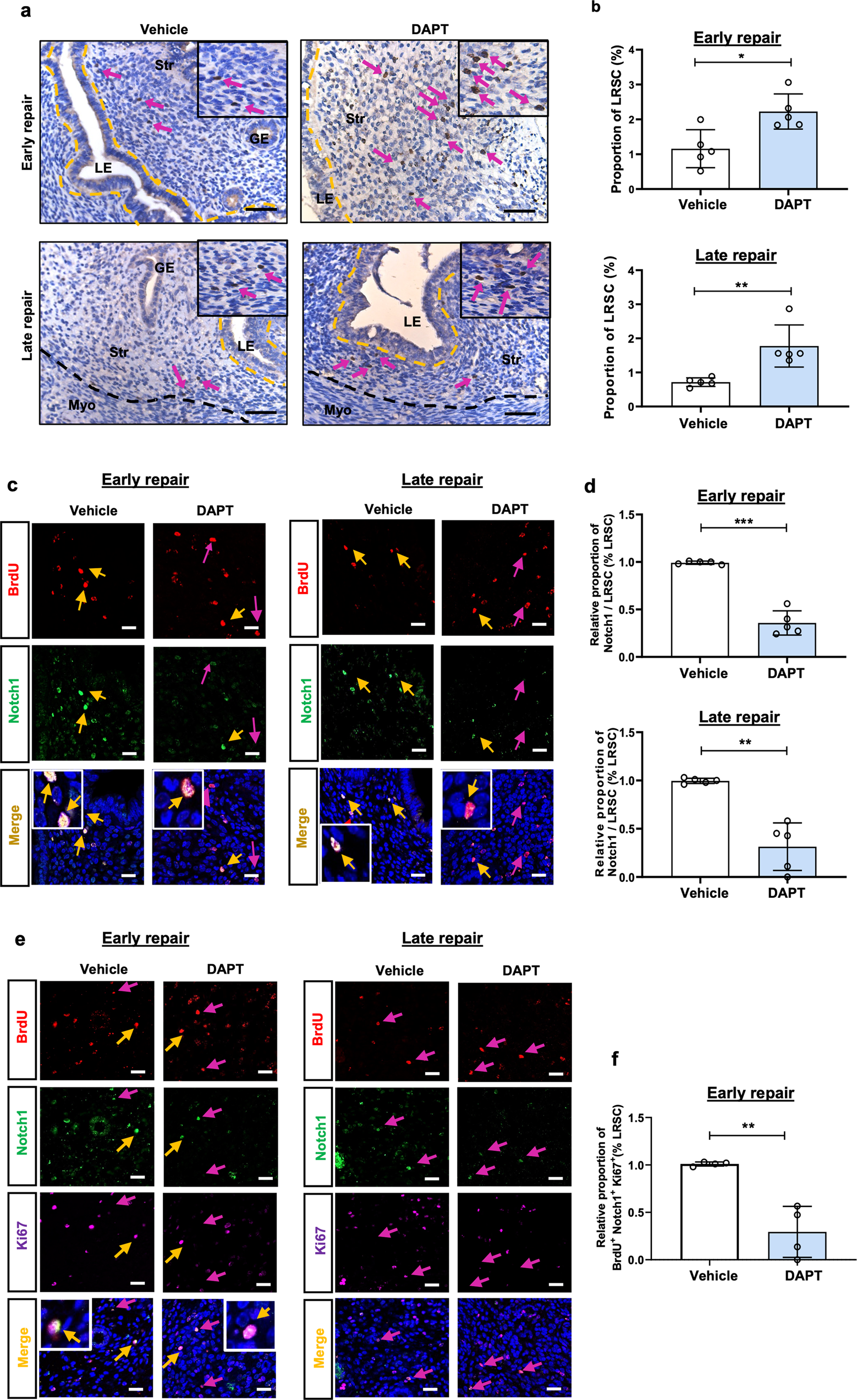 Fig. 9: DAPT treatment increases the proportion of LRSC at early and late repair.