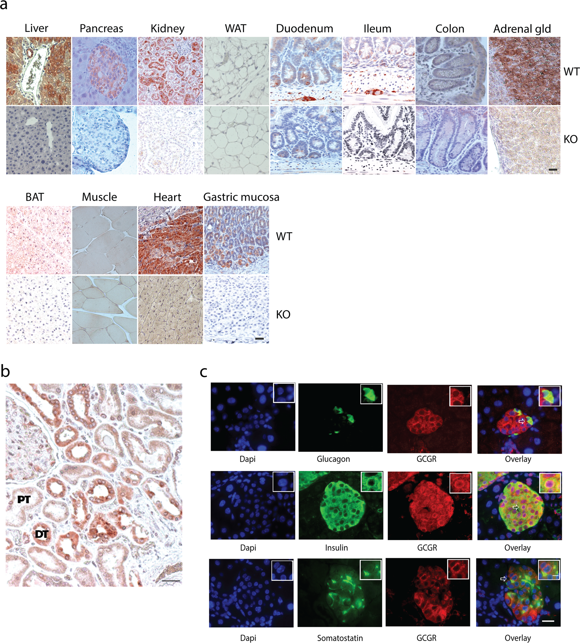 Fig. 3: GCGR expression using immunohistochemistry.