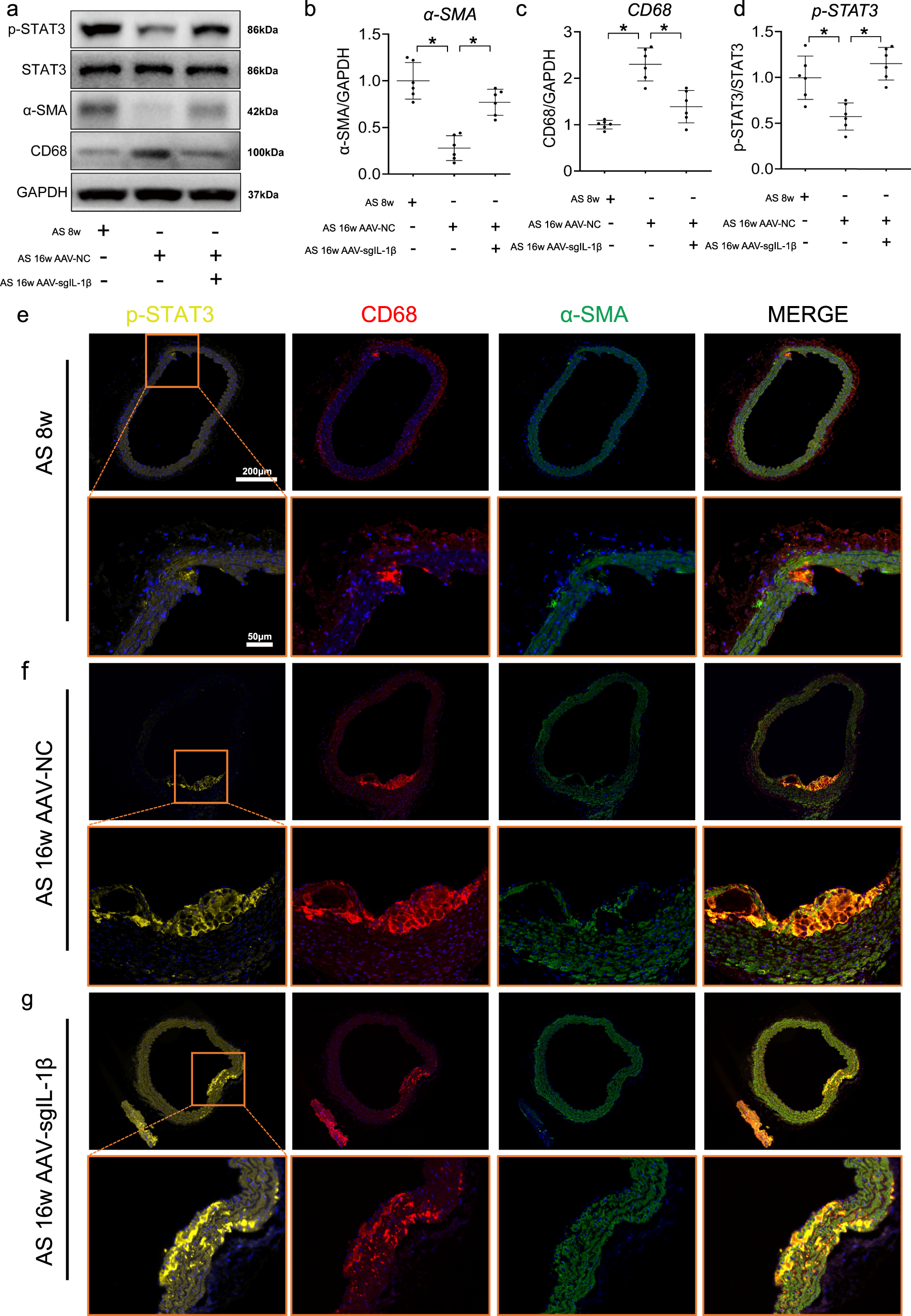 Fig. 8: In vivo experiments identify the inverse correlations of IL-1β with STAT3 in aorta of mice.