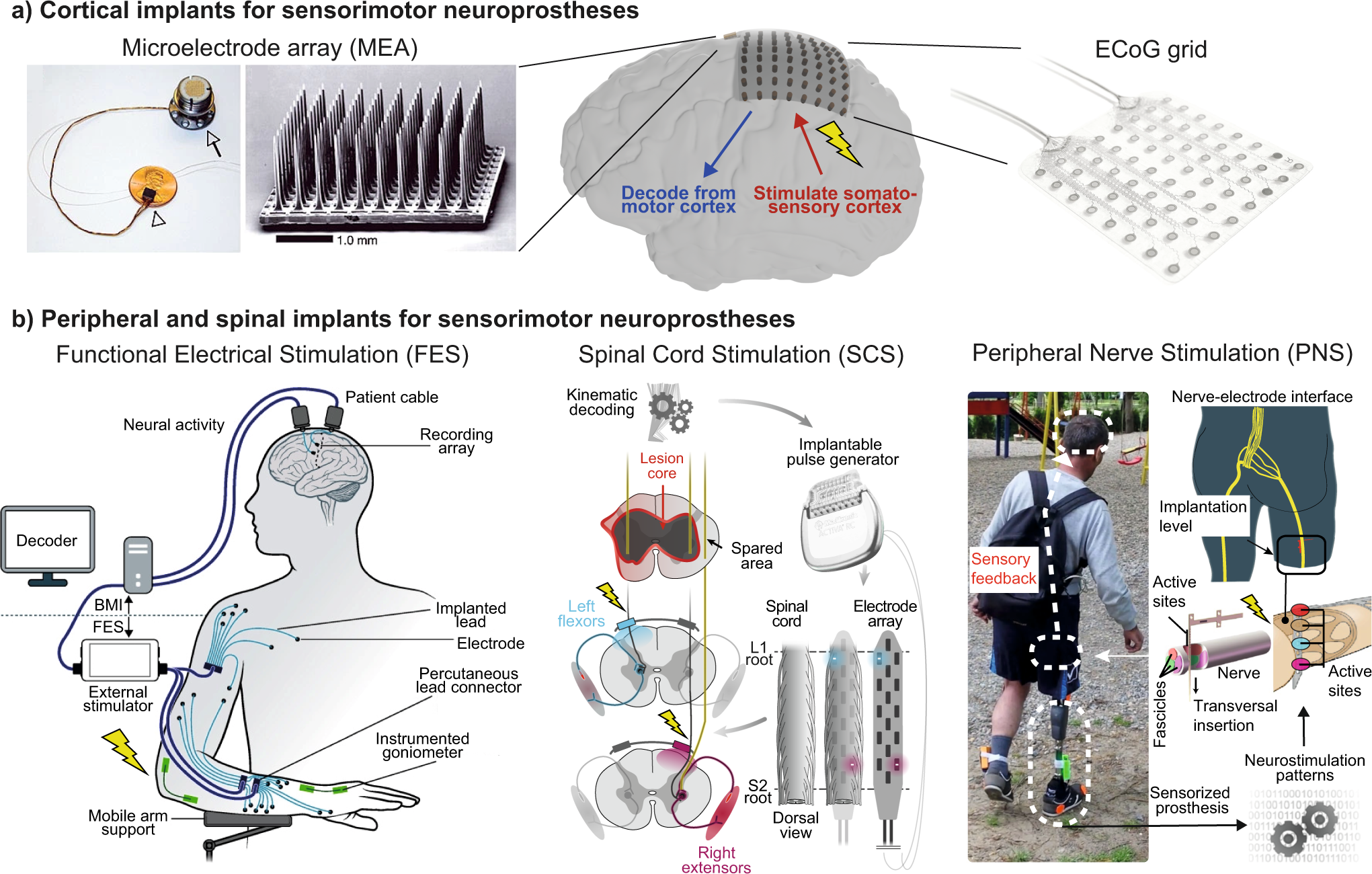 Neuroprosthetics: from sensorimotor to cognitive disorders | Communications  Biology