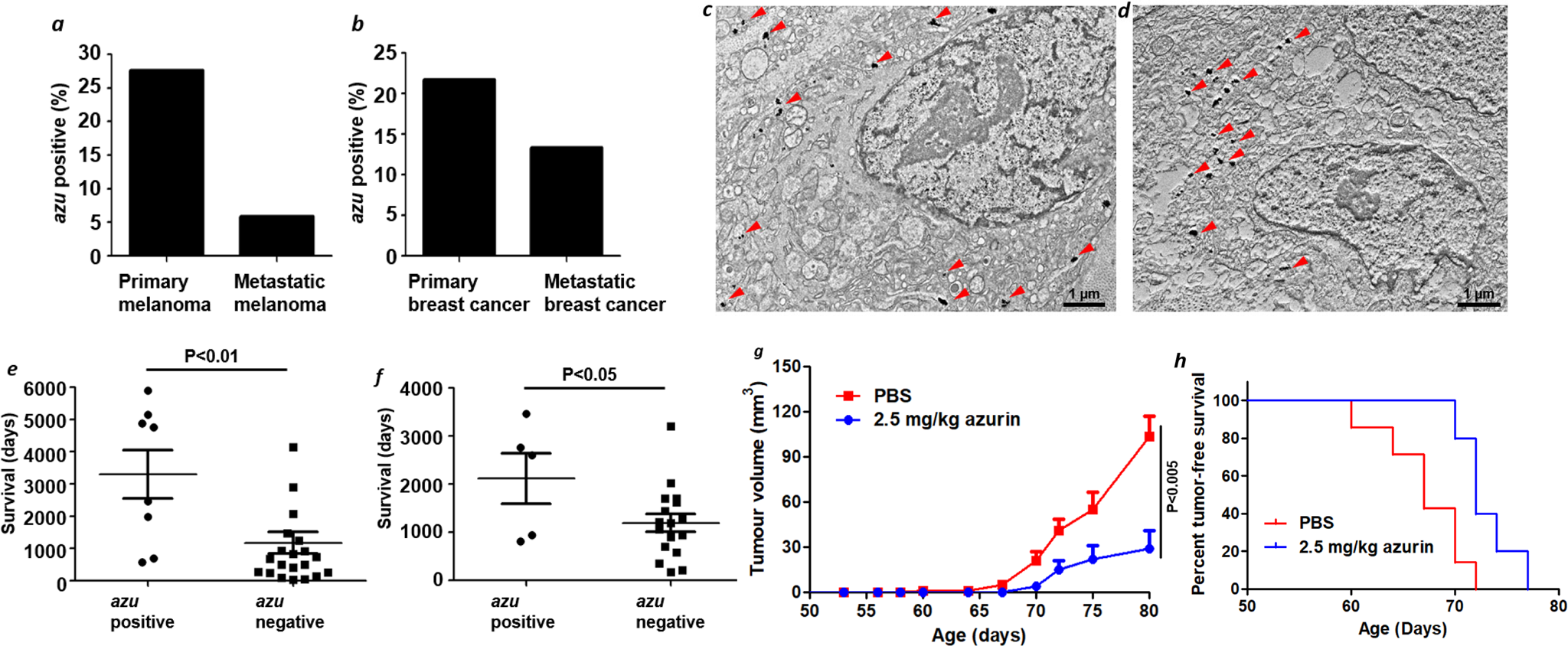 Fig. 4: Azurin-producing P. aeruginosa in human tumors.
