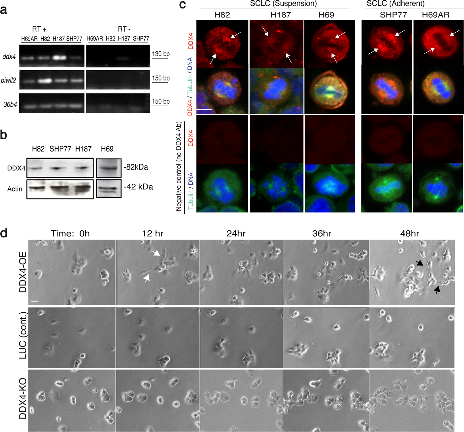 The germline factor DDX4 contributes to the chemoresistance of small cell  lung cancer cells | Communications Biology