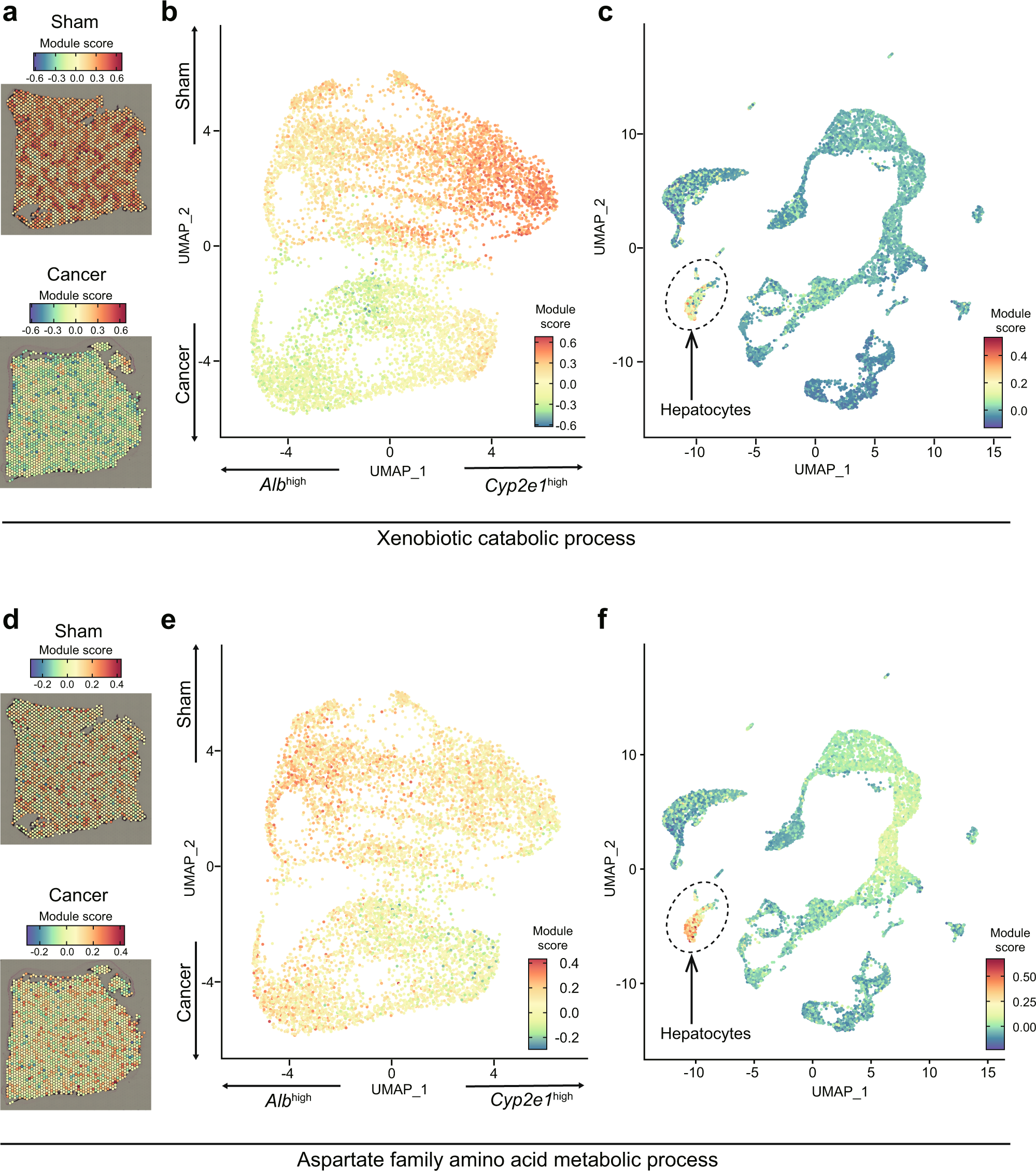 Fig. 3: 4T1 breast cancers disrupt liver zonation in various manners.