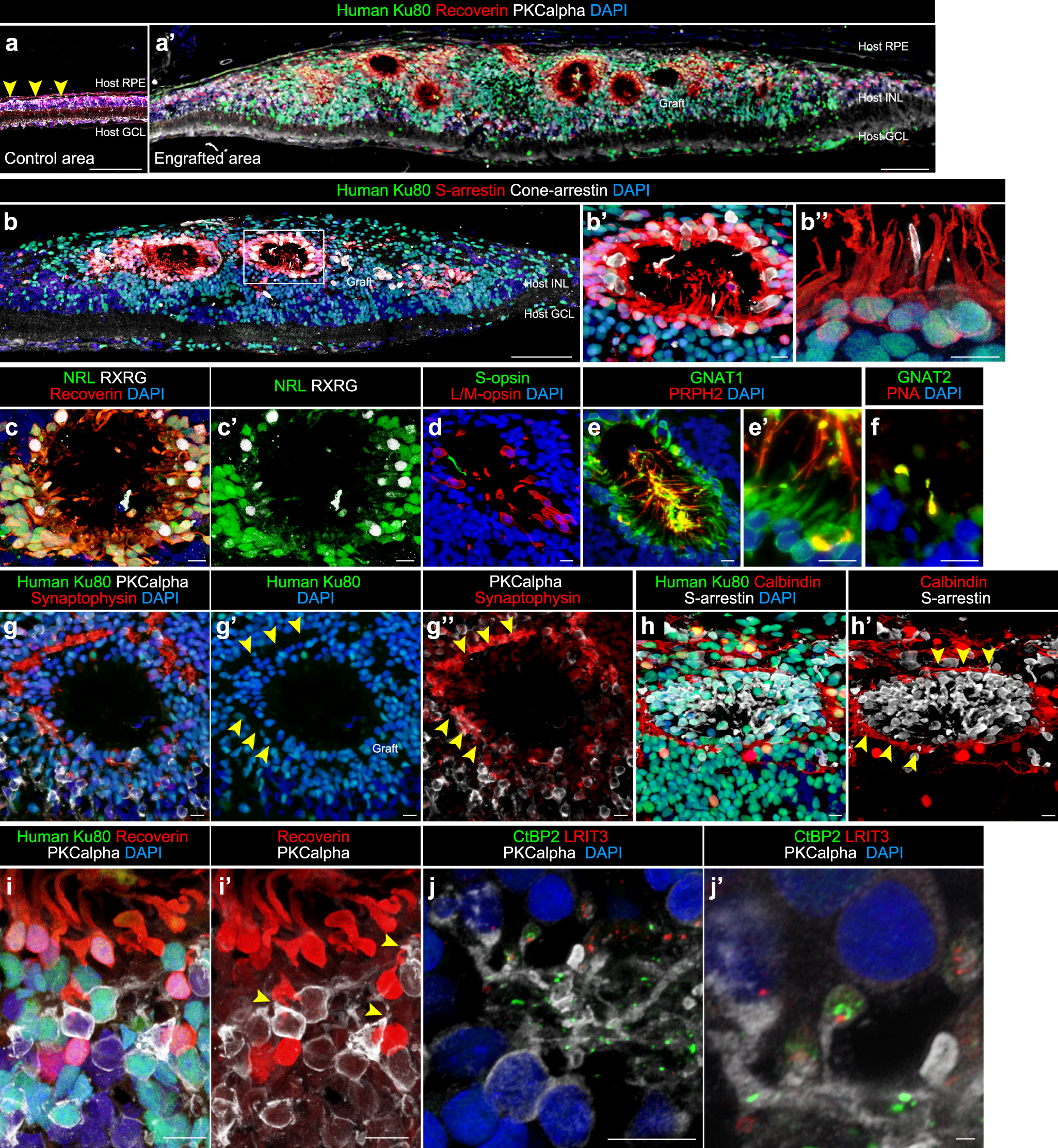 Fig. 6: Engraftment and photoreceptor maturation of iPSC-retinal sheets after subretinal transplantation in RD-nude rats.