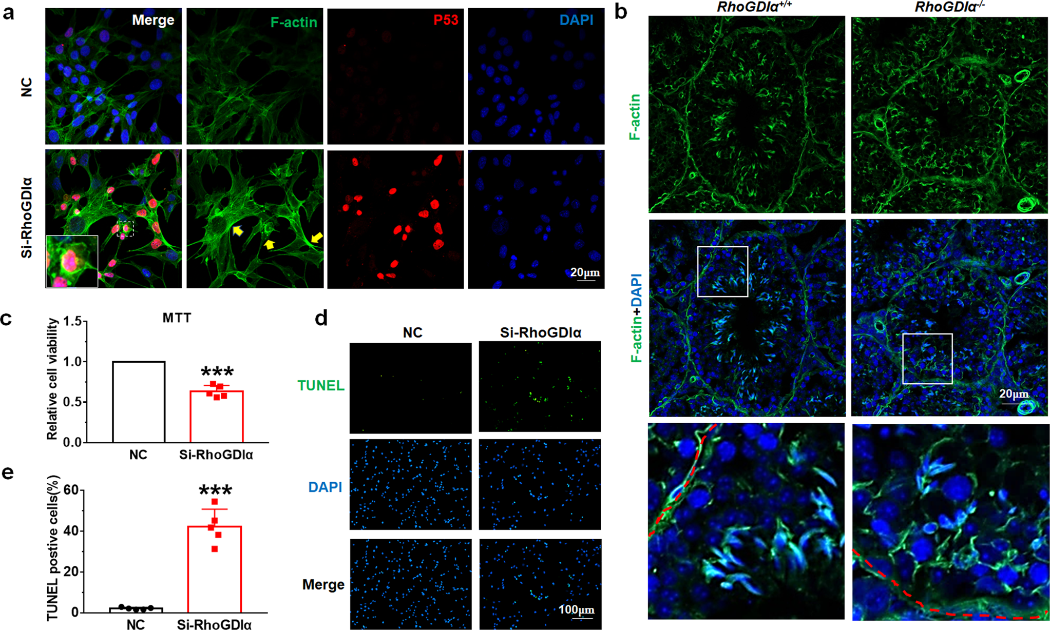 Fig. 5: F-actin polymerization and apoptosis occurred after RhoGDIα deletion.