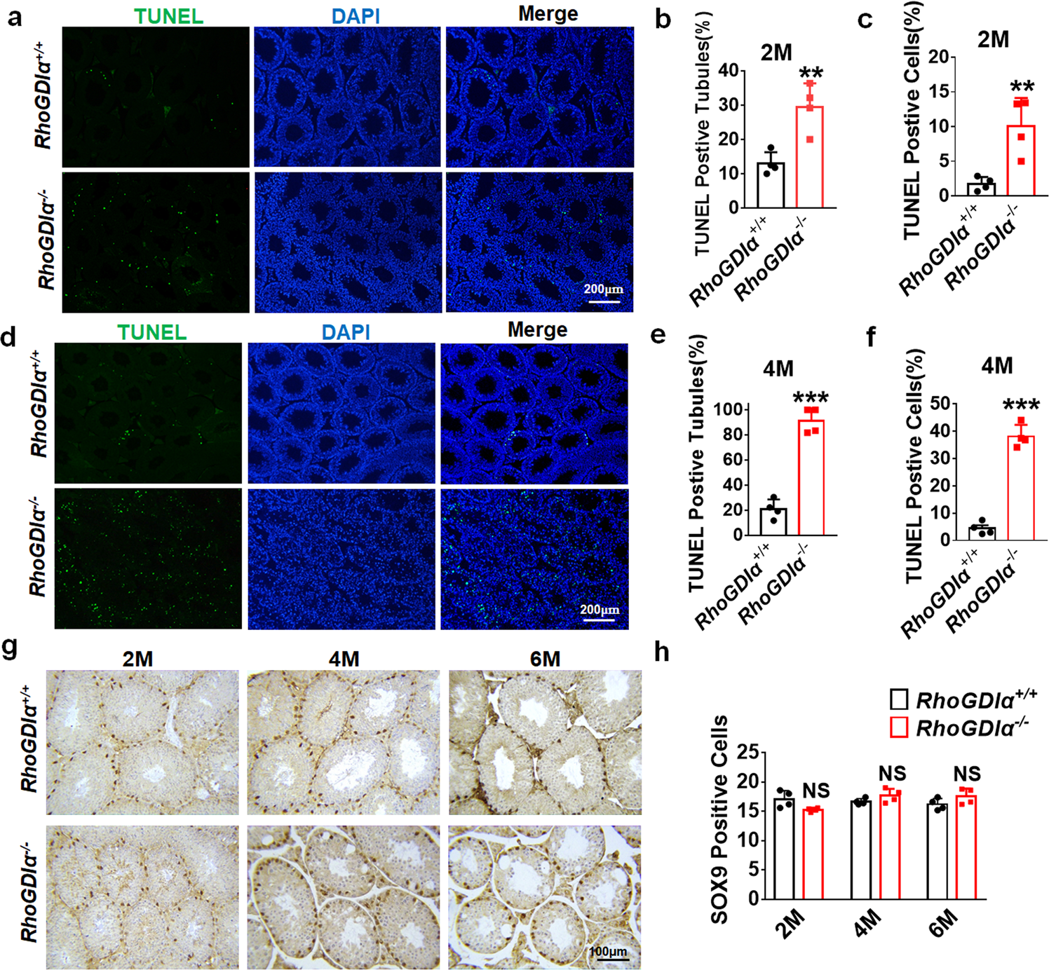 Fig. 6: Apoptosis was detected in the testes of RhoGDIα+/+ and RhoGDIα−/− mice.