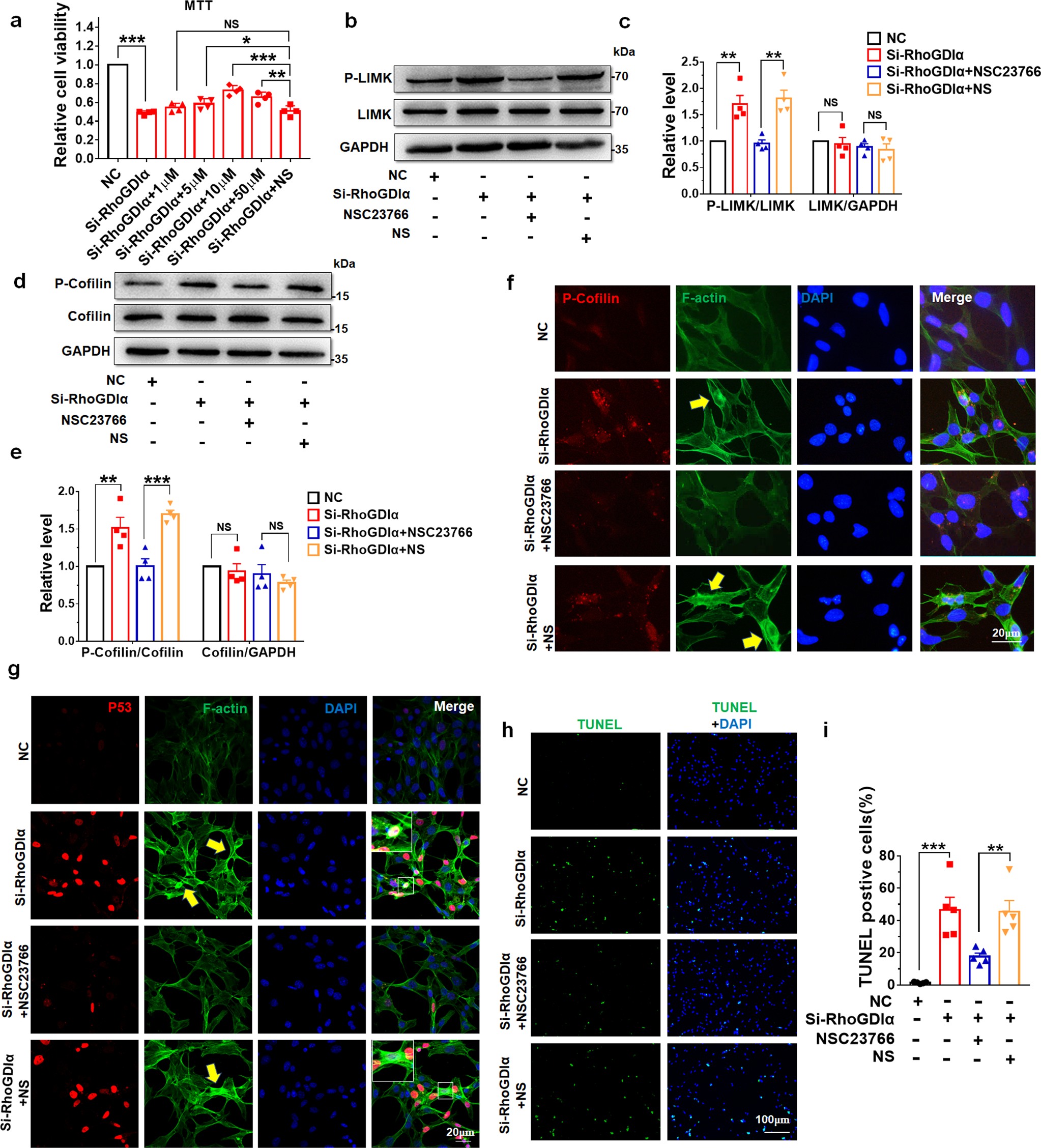 Fig. 7: NSC23766 mitigated the effects of RhoGDIα knockdown on GC1-spg cells.