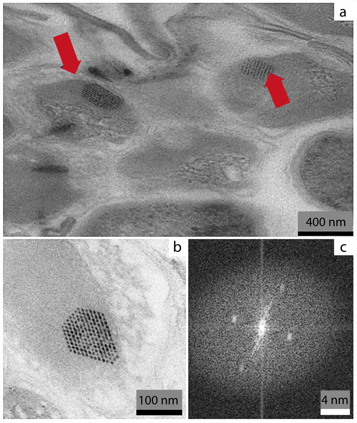 Fig. 2: Transmission electron photomicrographs (magnification 71,000×) showing the highly symmetrical bacterial microcompartments (BMCs)/carboxysome-like structures.