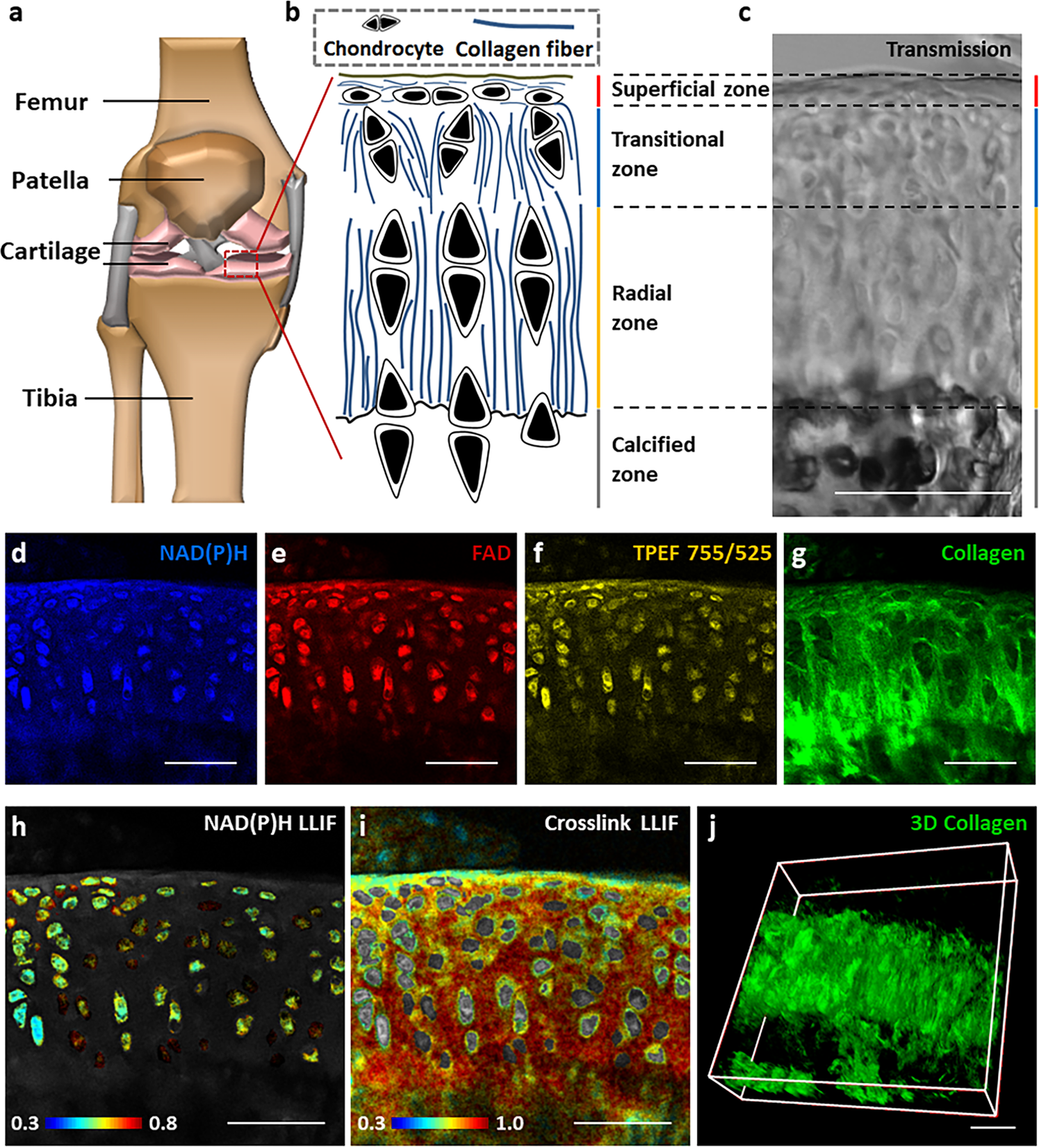 Label-free, multi-parametric assessments of cell metabolism and matrix remodeling within human and early-stage murine osteoarthritic articular cartilage Communications Biology