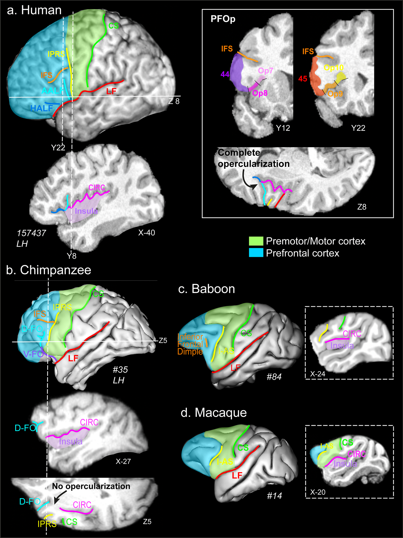 Parts of the Brain and Their Functions, image size:1350x1803