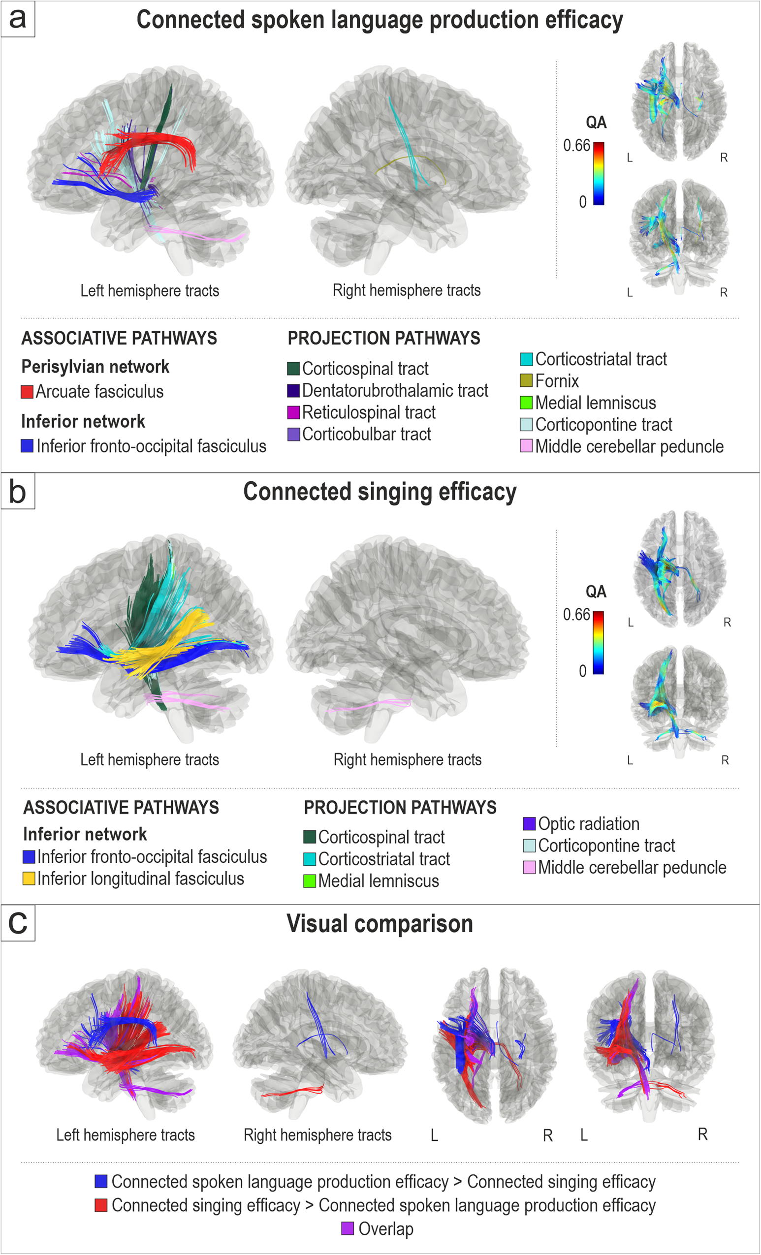 Hodological organization of spoken language production and singing in the human brain