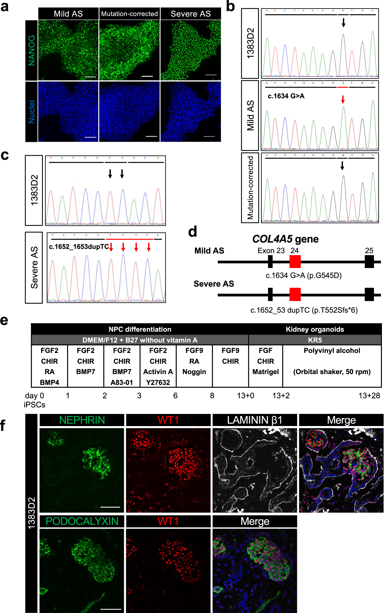 Fig. 1: Establishment of AS patient and COL4A5 gene mutation-corrected iPSCs and generation of kidney organoids.