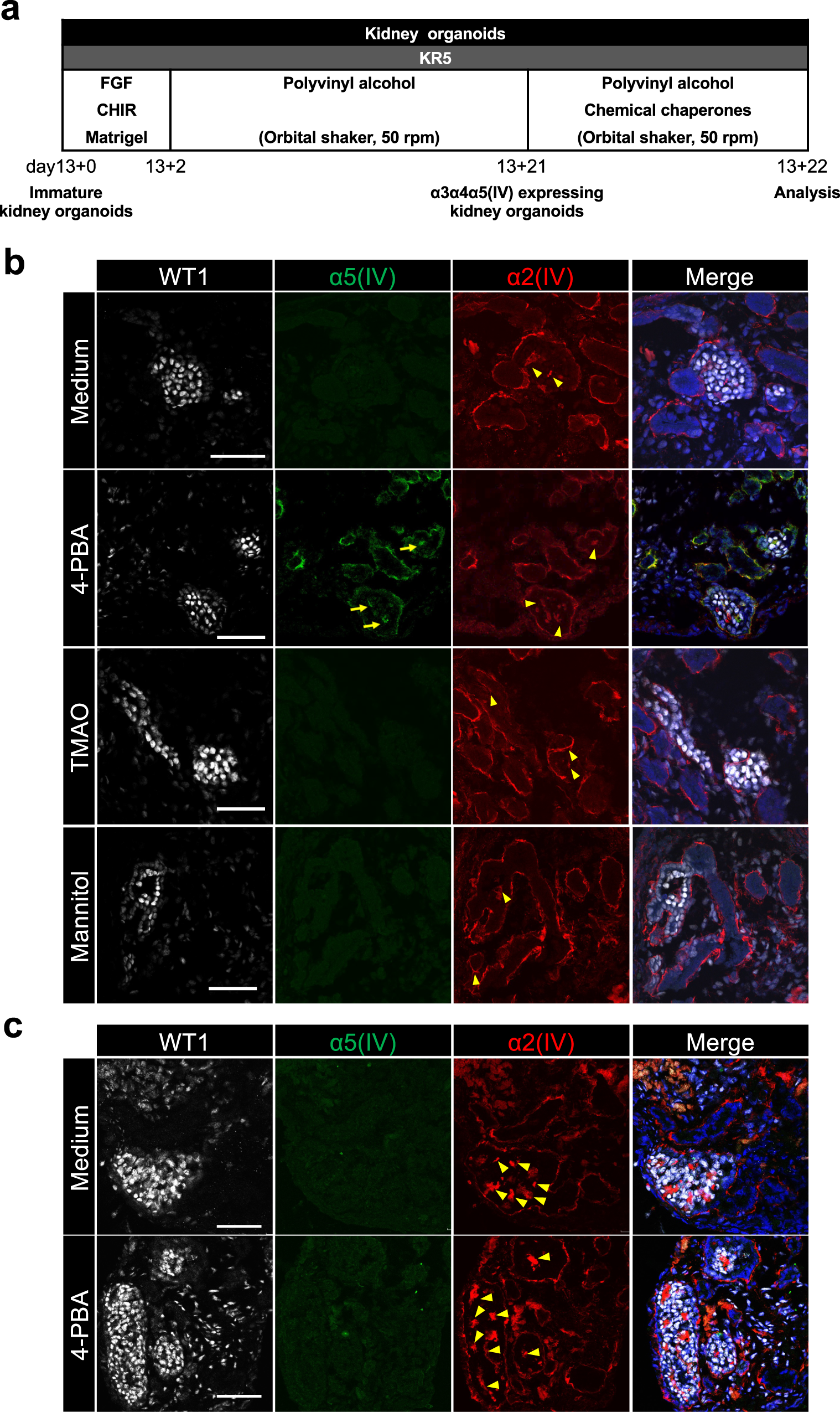 Fig. 5: Treatment with 4-PBA restores α5(IV) expression in mild AS patient iPSC-derived kidney organoids.