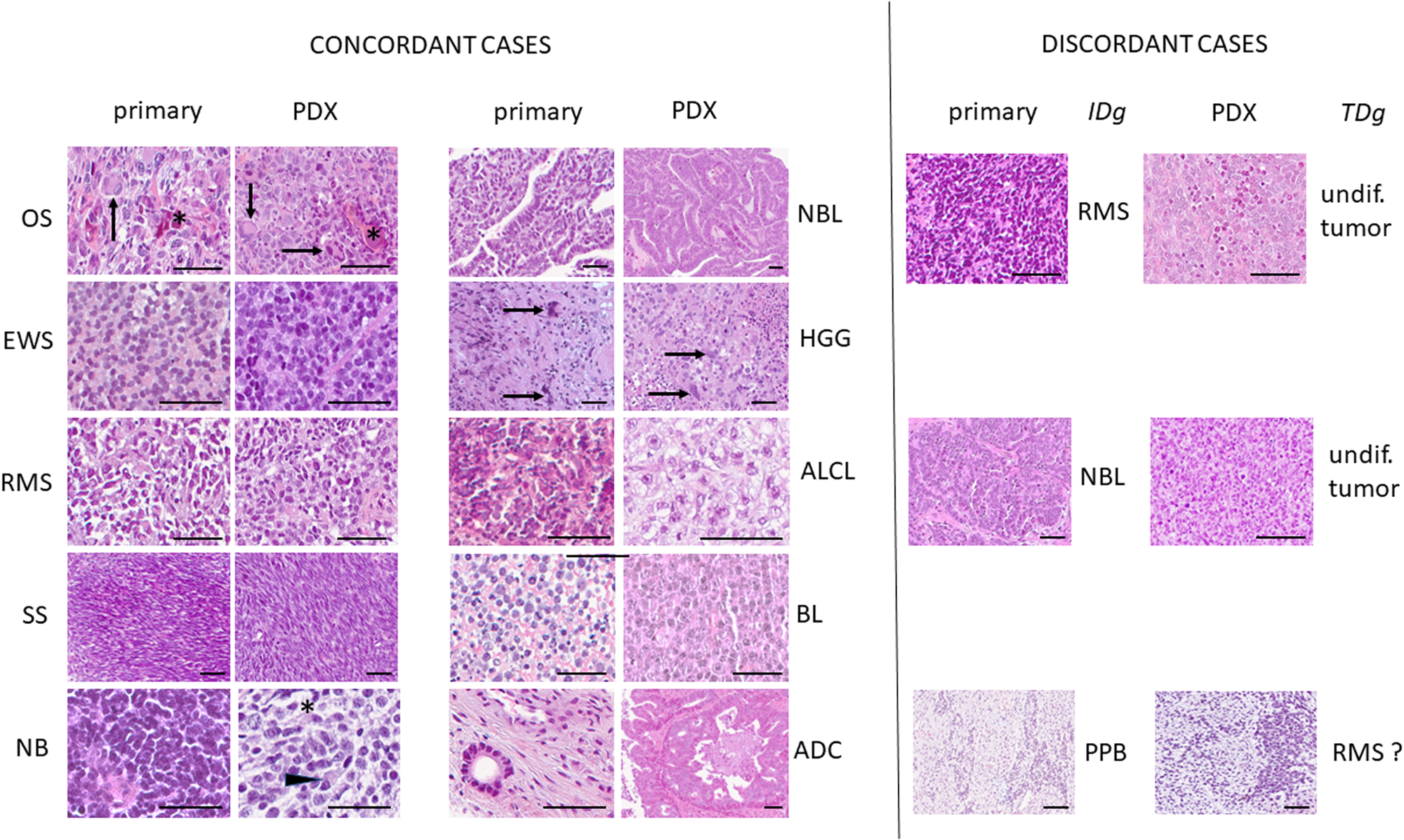 Fig. 3: Comparative histological study between primary and PDX tumors.