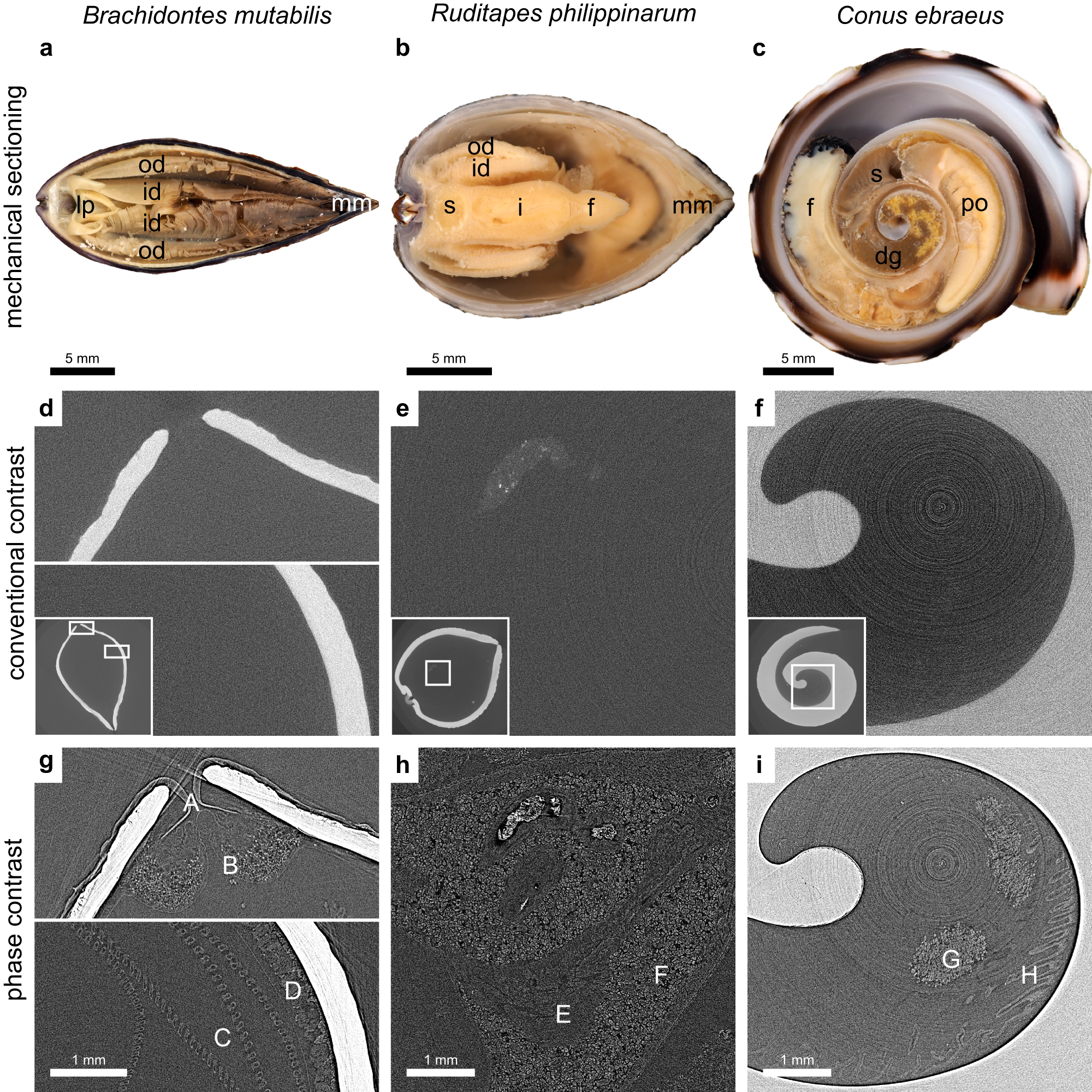 Fig. 3: Phase contrast enables a drastic improvement in soft-tissue visualization.