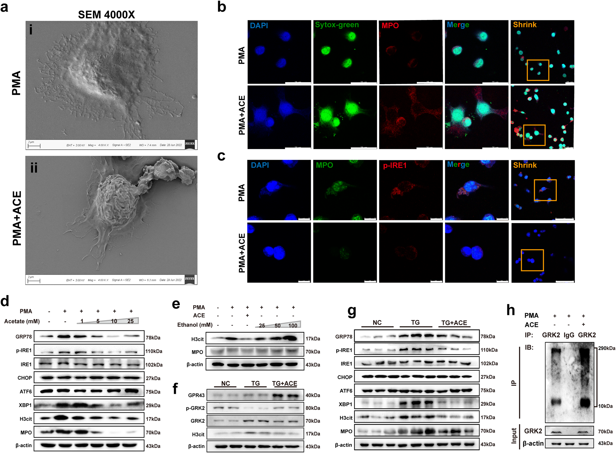 Fig. 6: Acetate reduces ERS in neutrophils and inhibits the formation of NETs.