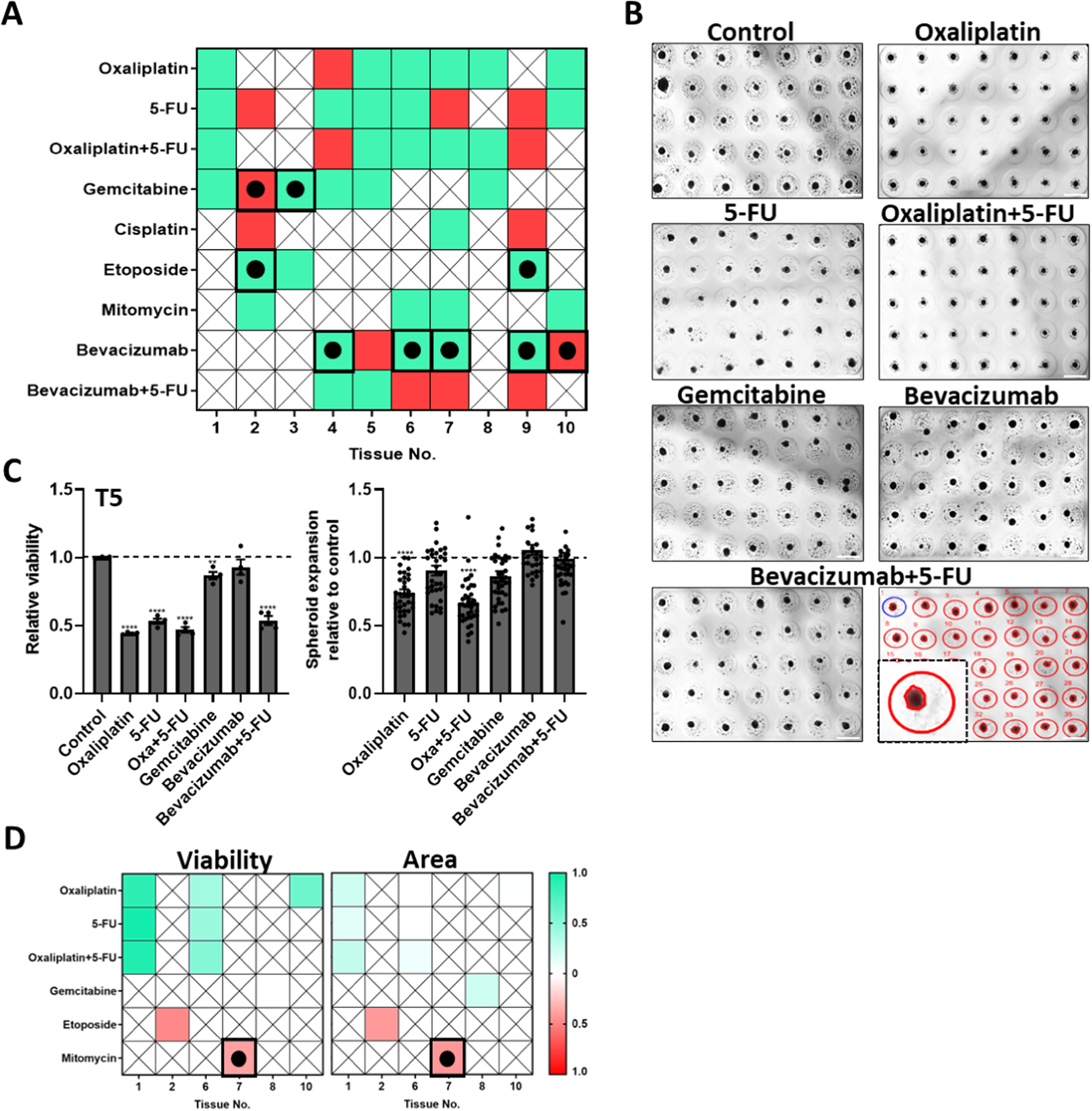 Fig. 5: Chemotherapy testing on patient-derived tumor spheroids.