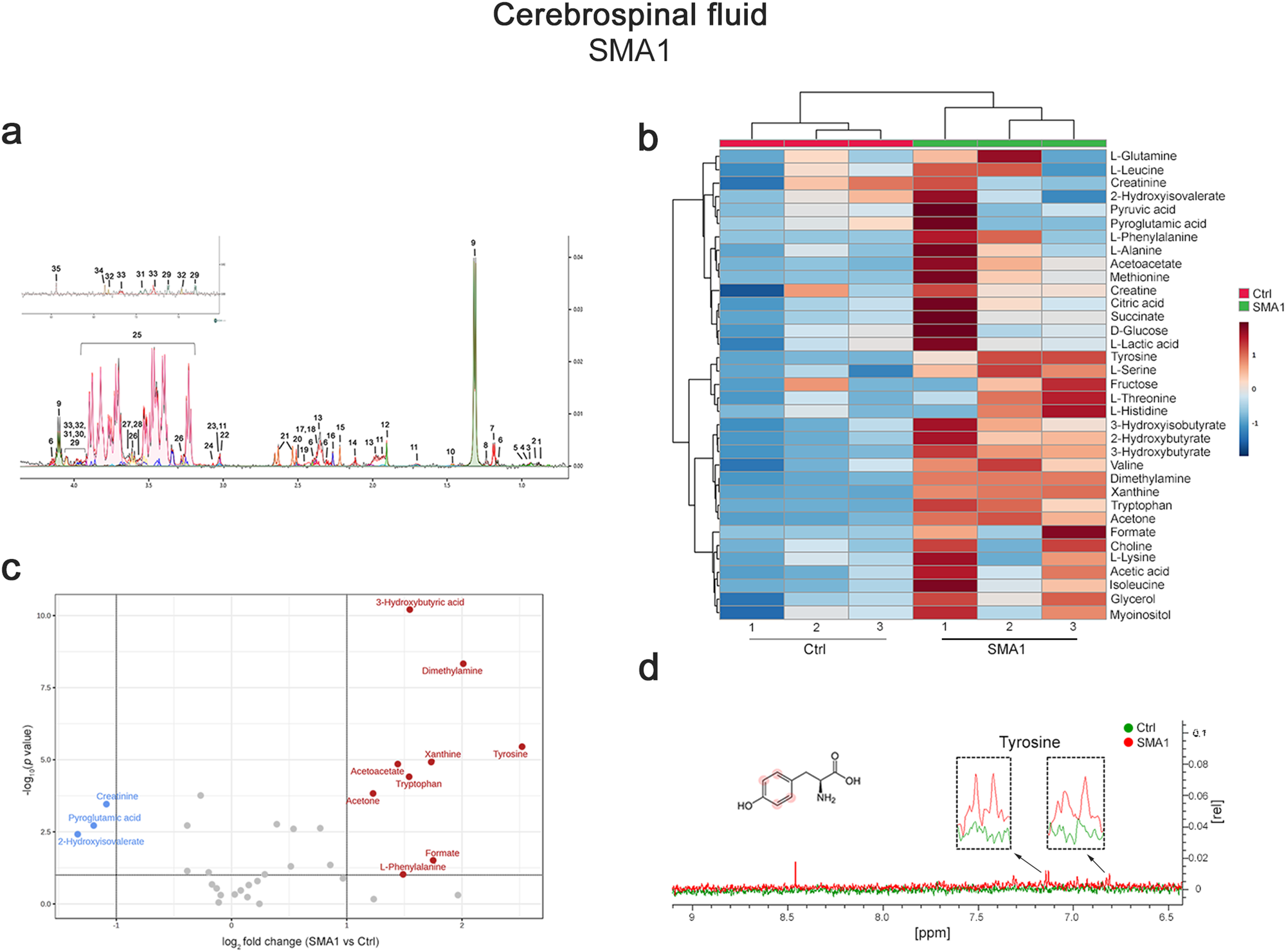 Fig. 8: Untargeted NMR-based metabolome analysis in a cohort of naïve SMA1 patients and healthy control subjects.