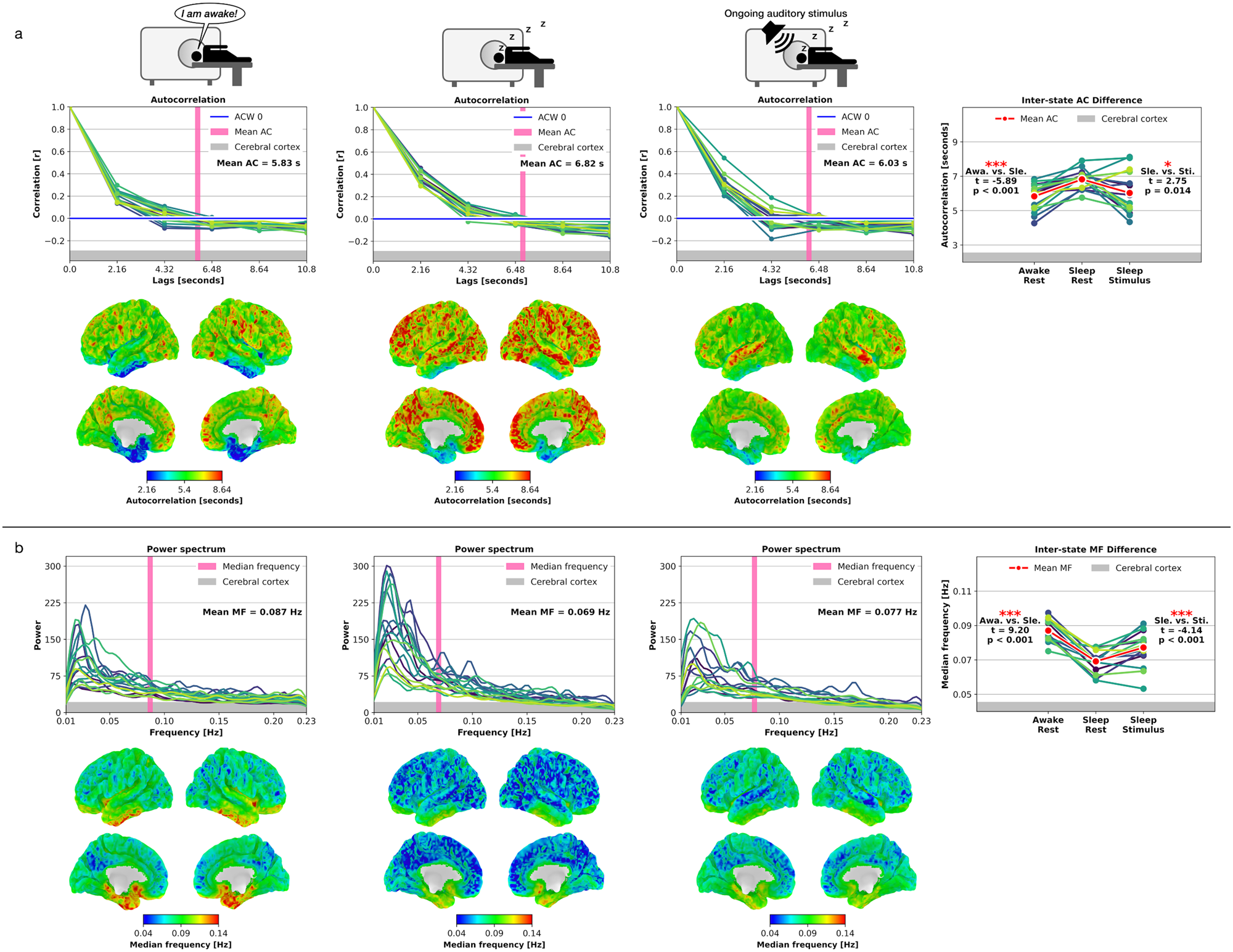 Fig. 4: Temporal autocorrelation (AC) and median frequency (MF) results for the cerebral cortex in Awake-Rest, Sleep-Rest, and Sleep-Stimulus.