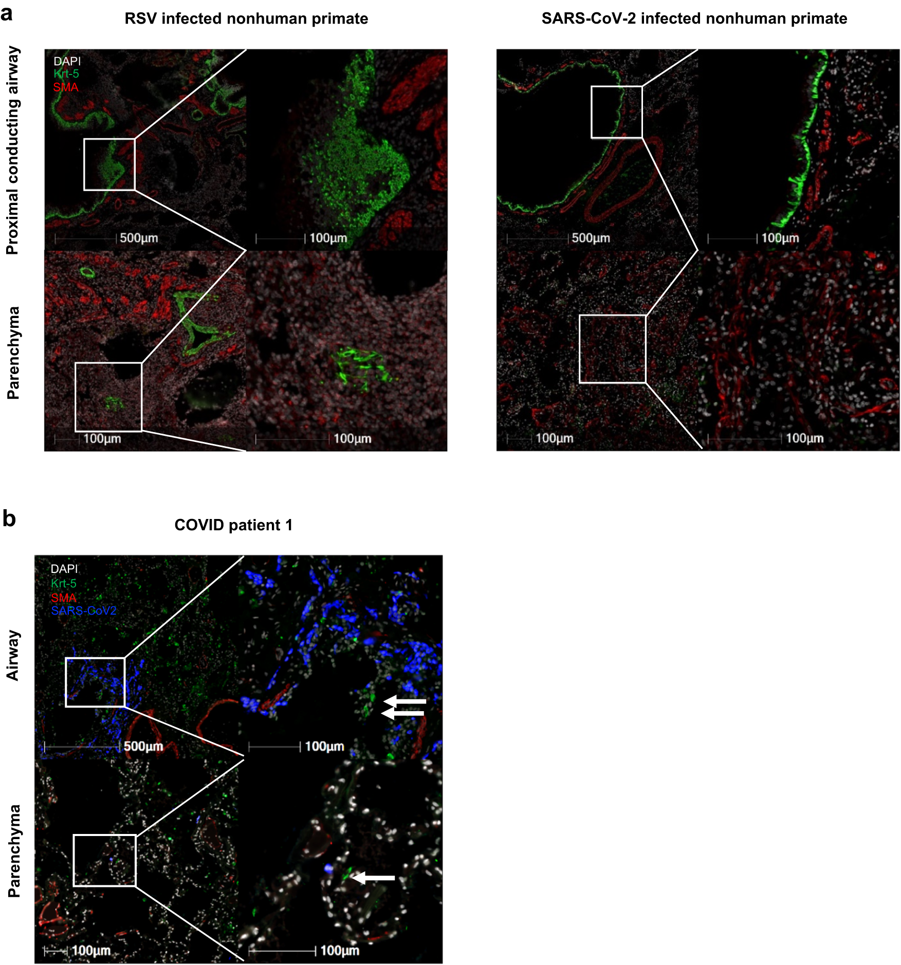 Fig. 6: No Krt5+ progenitor cells proliferate in CoV2-infected nonhuman primates or human patients.