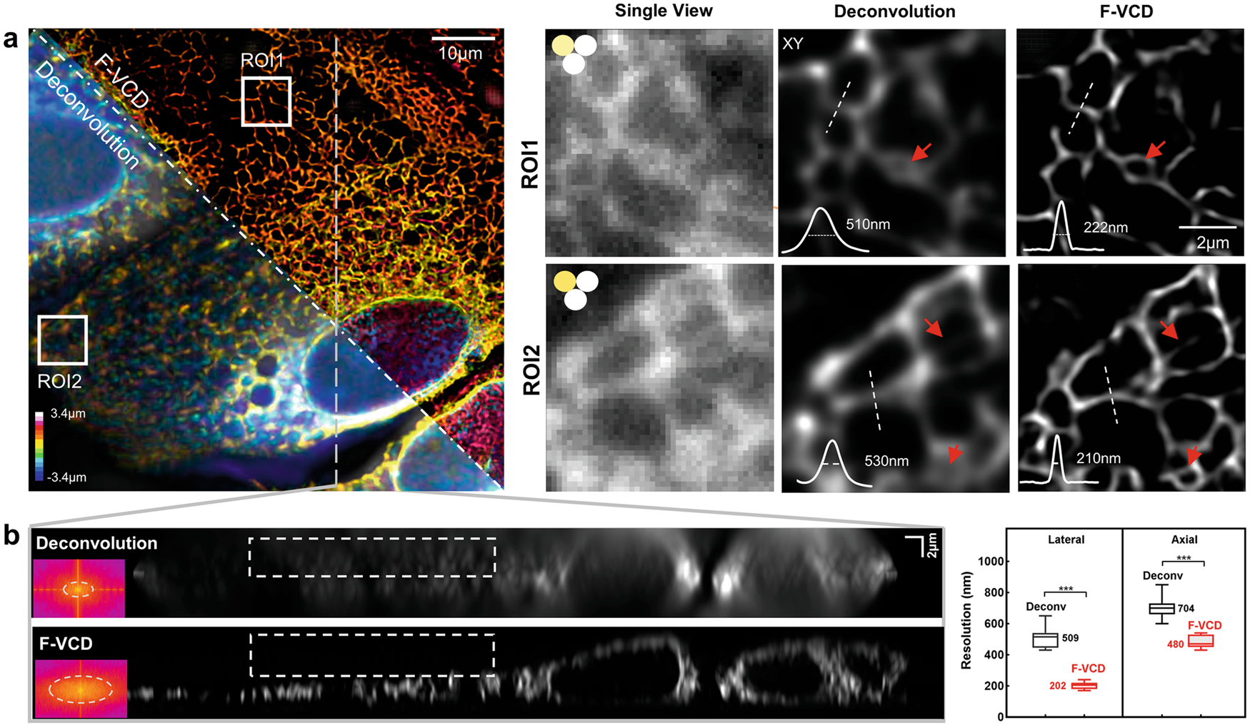 Fig. 4: 3D imaging of fixed endoplasmic reticulum with F-VCD.