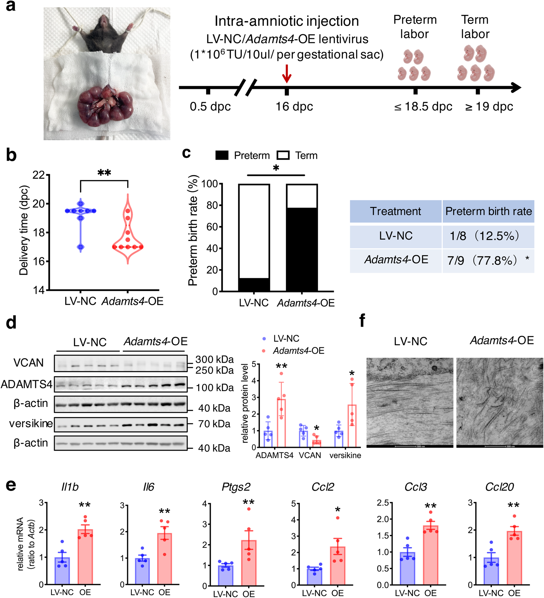 Fig. 8: Induction of preterm birth by intra-amniotic injection of lentiviral vector expressing ADAMTS4 in the mouse.