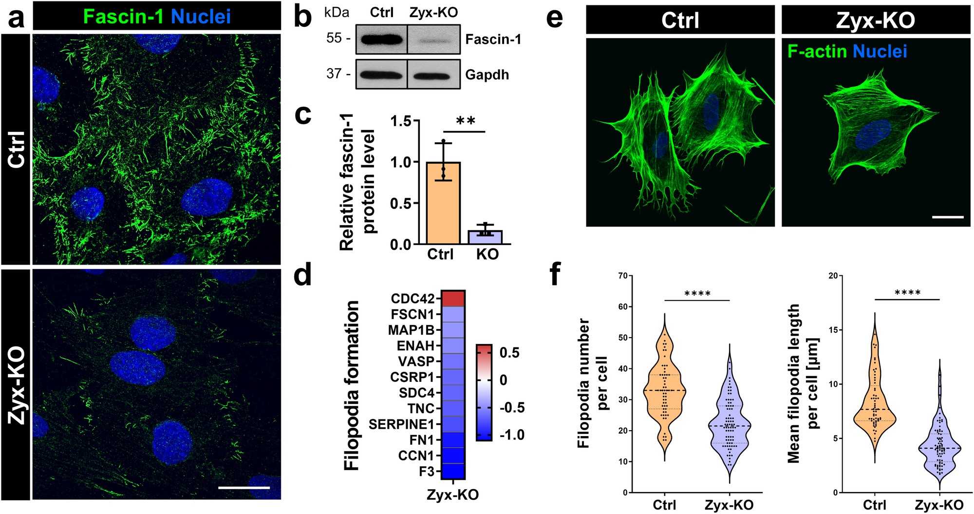 Fig. 5: The loss of zyxin reduced the number and length of filopodia in cultured podocytes due to a down-regulation of fascin-1.