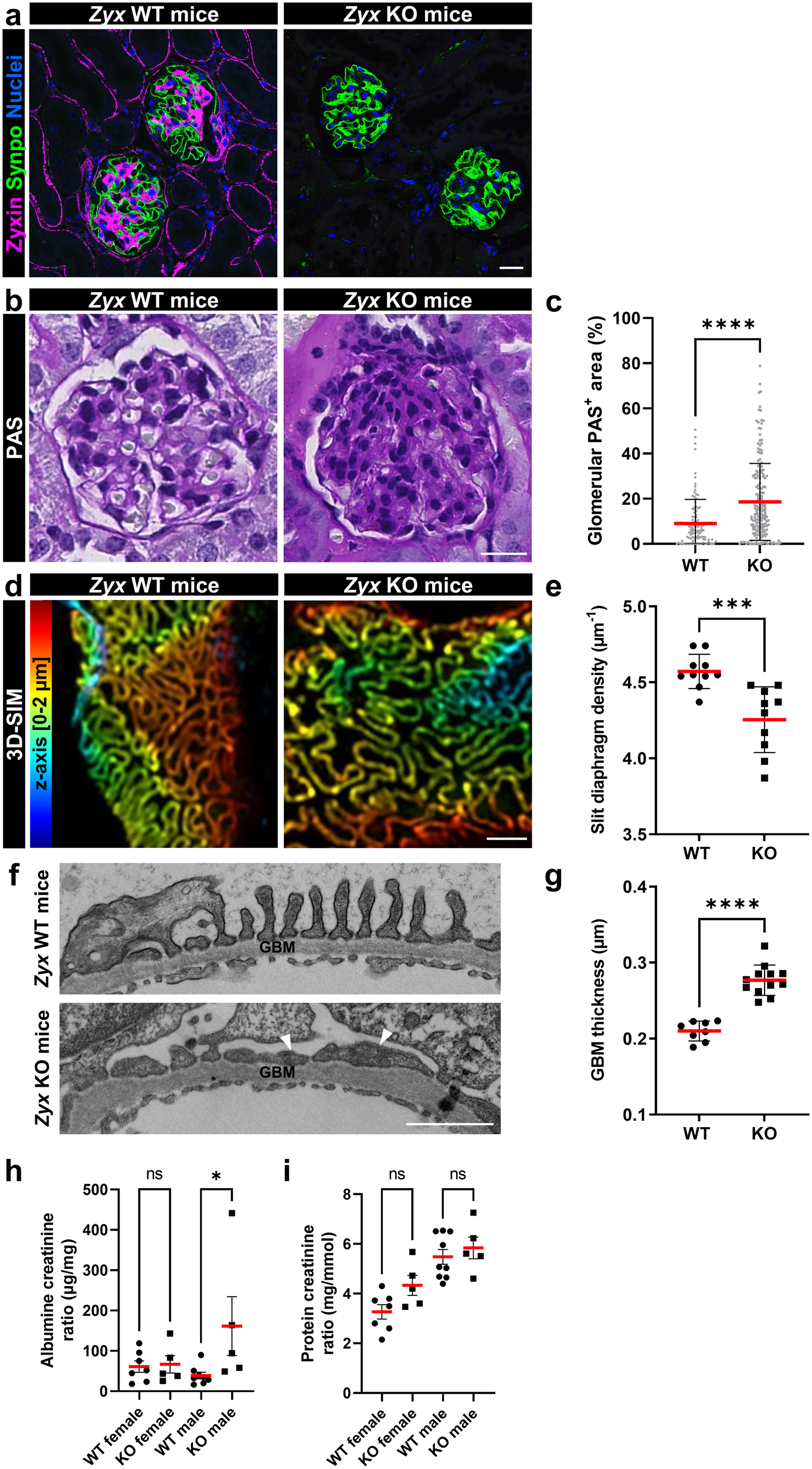 Fig. 7: Zyx KO mice showed expansion of the mesangial compartment, reduced slit membrane density and proteinuria.
