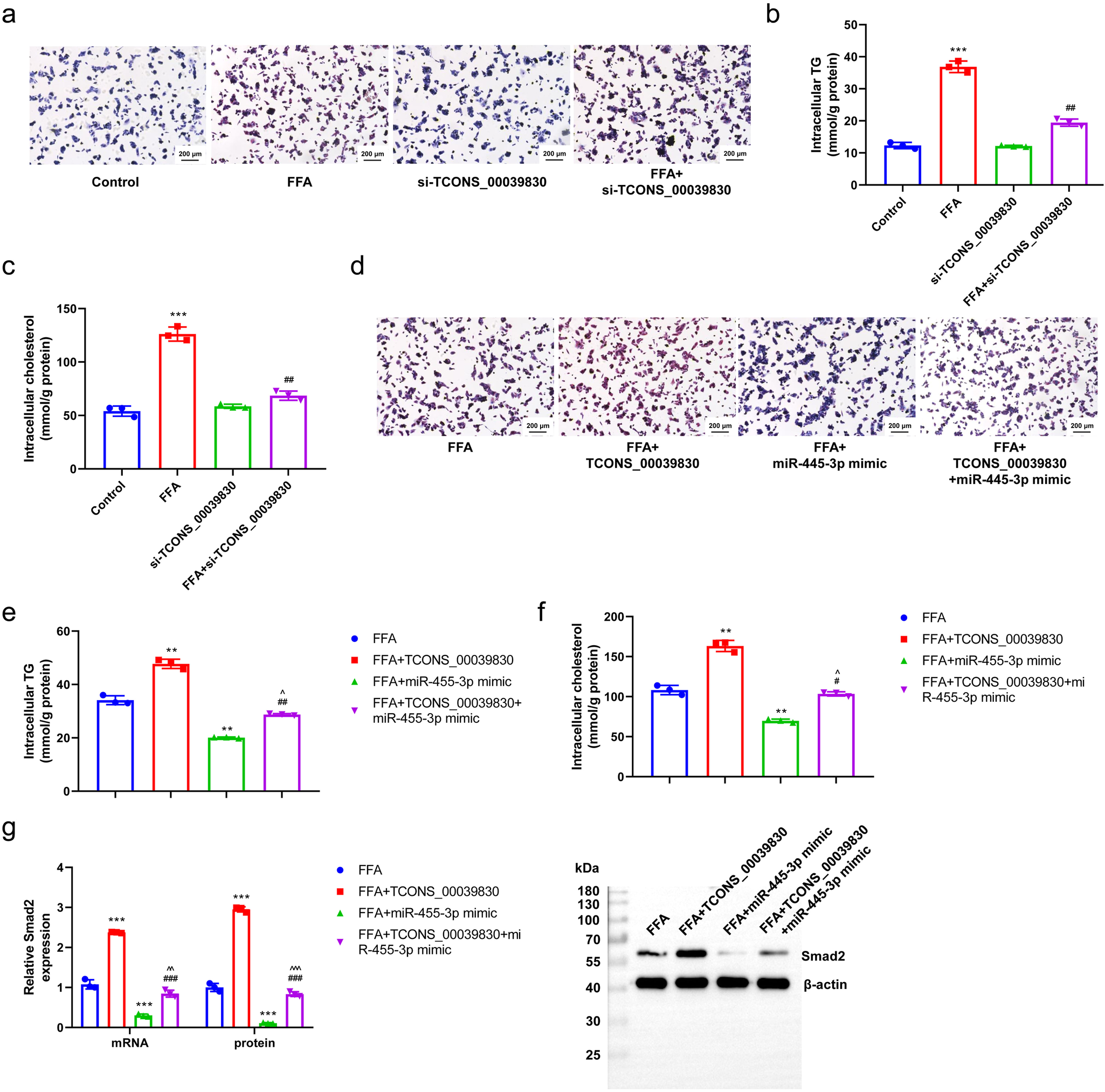 Fig. 6: Role of TCONS-00039830/miR-455-3p/Smad2 in hepatic steatosis.