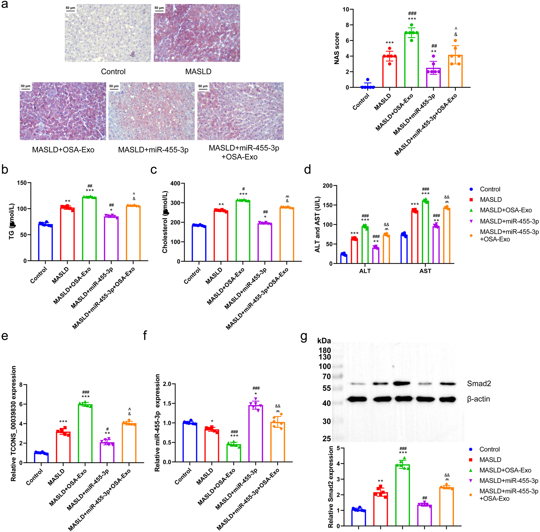 Fig. 9: Exosome-delivered TCONS_00039830 regulates fat accumulation through miR-455-3p.