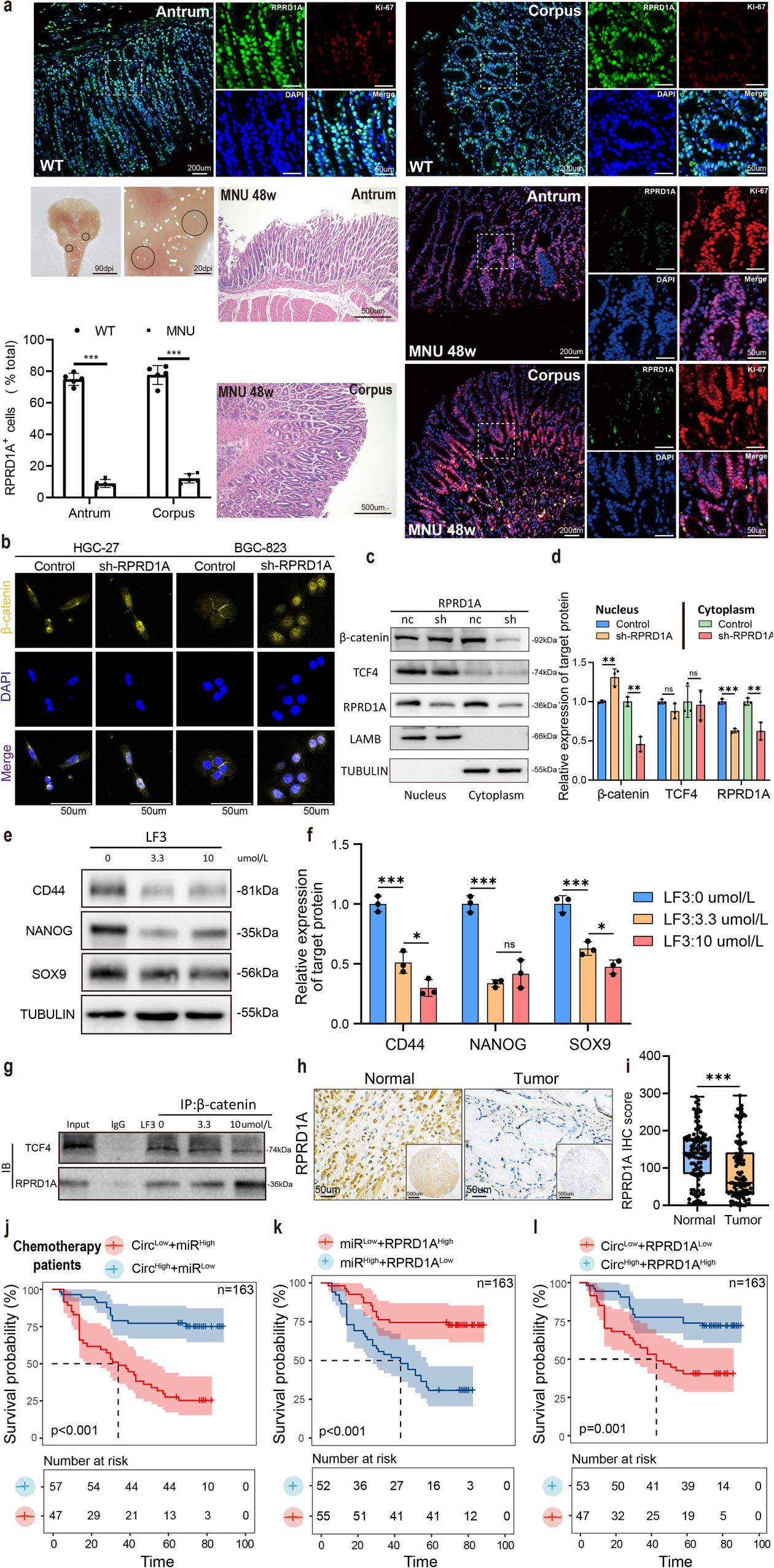 Fig. 7: Circ-0075305 hinders the stem-like properties of GC by competitively binding with β-catenin through the RPRD1A axis.