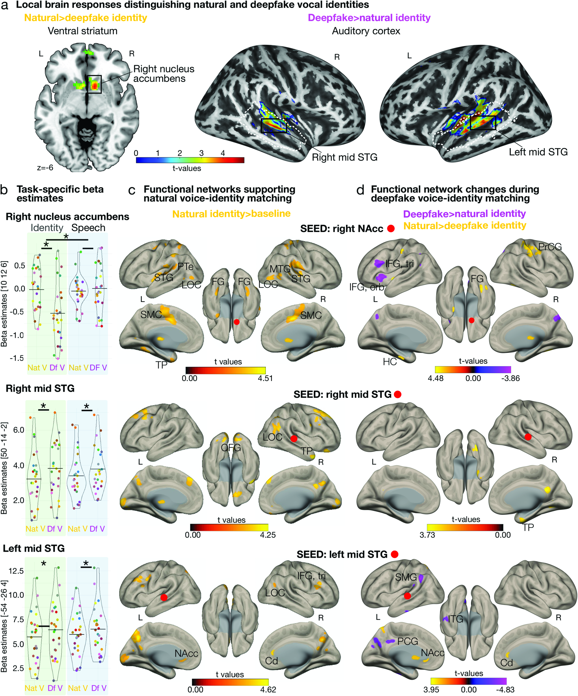 Fig. 2: Brain responses and functional networks for natural and deepfake speaker identities.