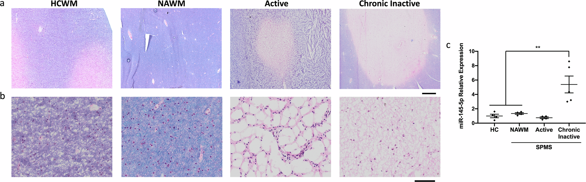 Fig. 1: miR-145-5p is upregulated in chronic lesion tissue from SPMS brains.