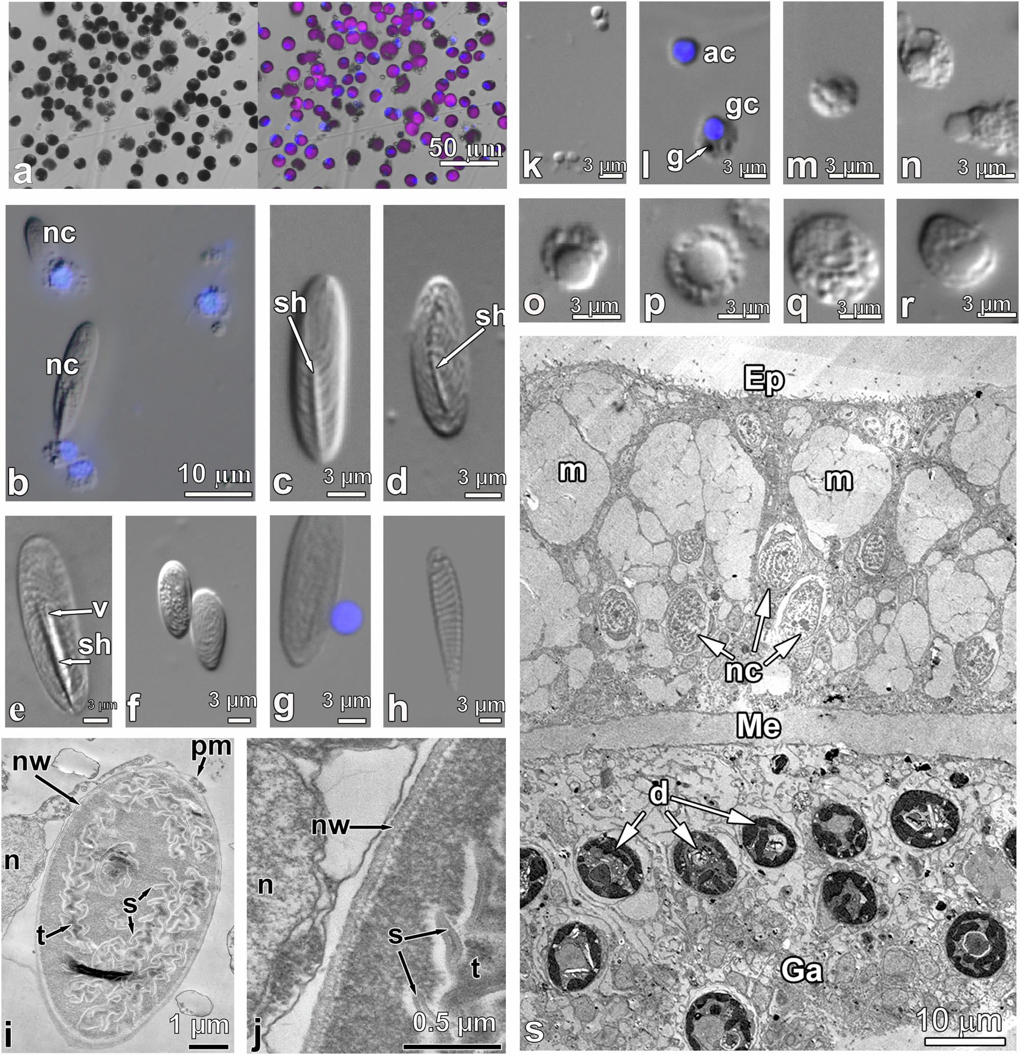 Fig. 1: Host cell types and symbionts of Acropora aspera.
