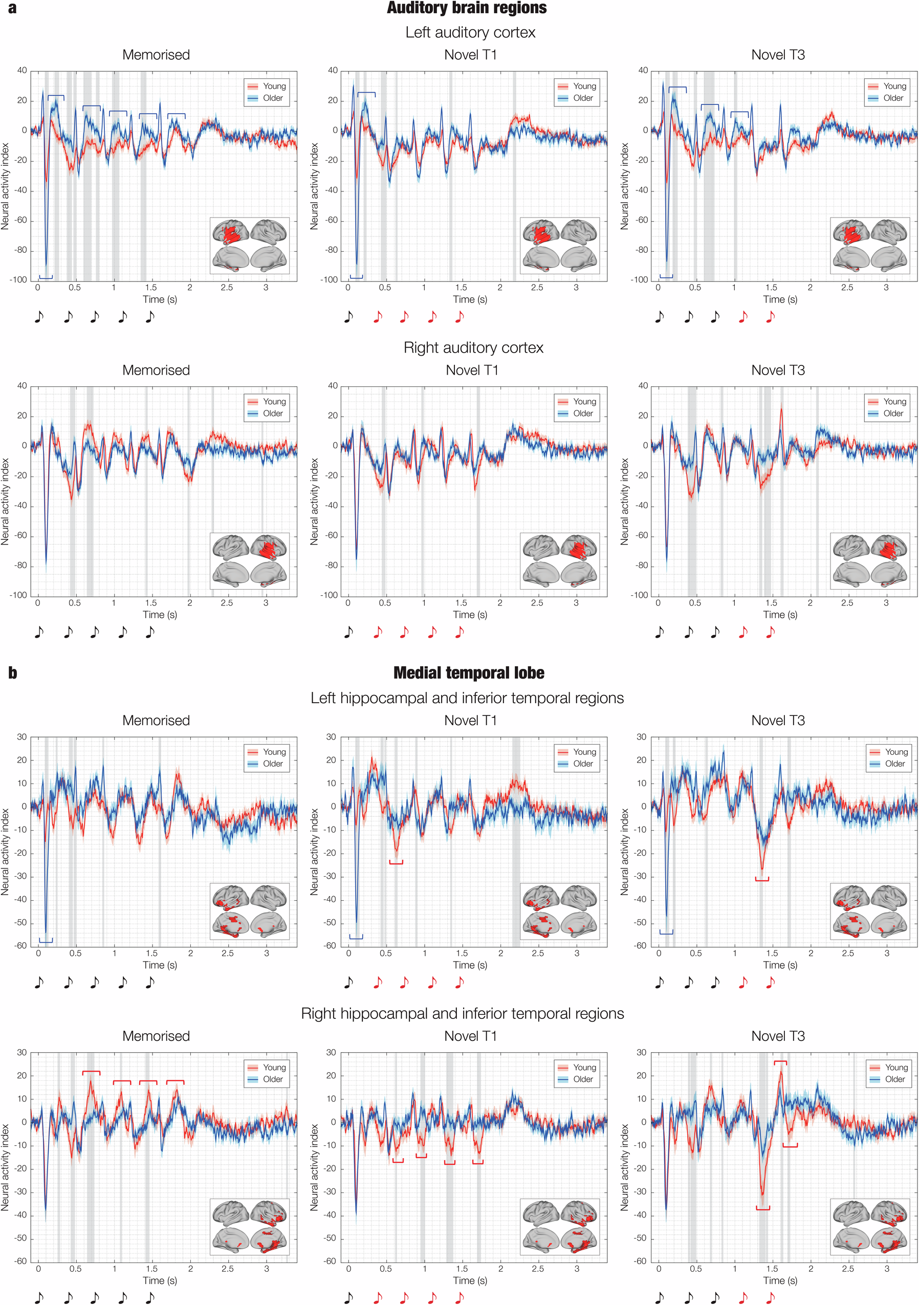 Fig. 3: Older adults show stronger activity in auditory cortex and reduced responses in medial temporal lobe during recognition of musical sequences.