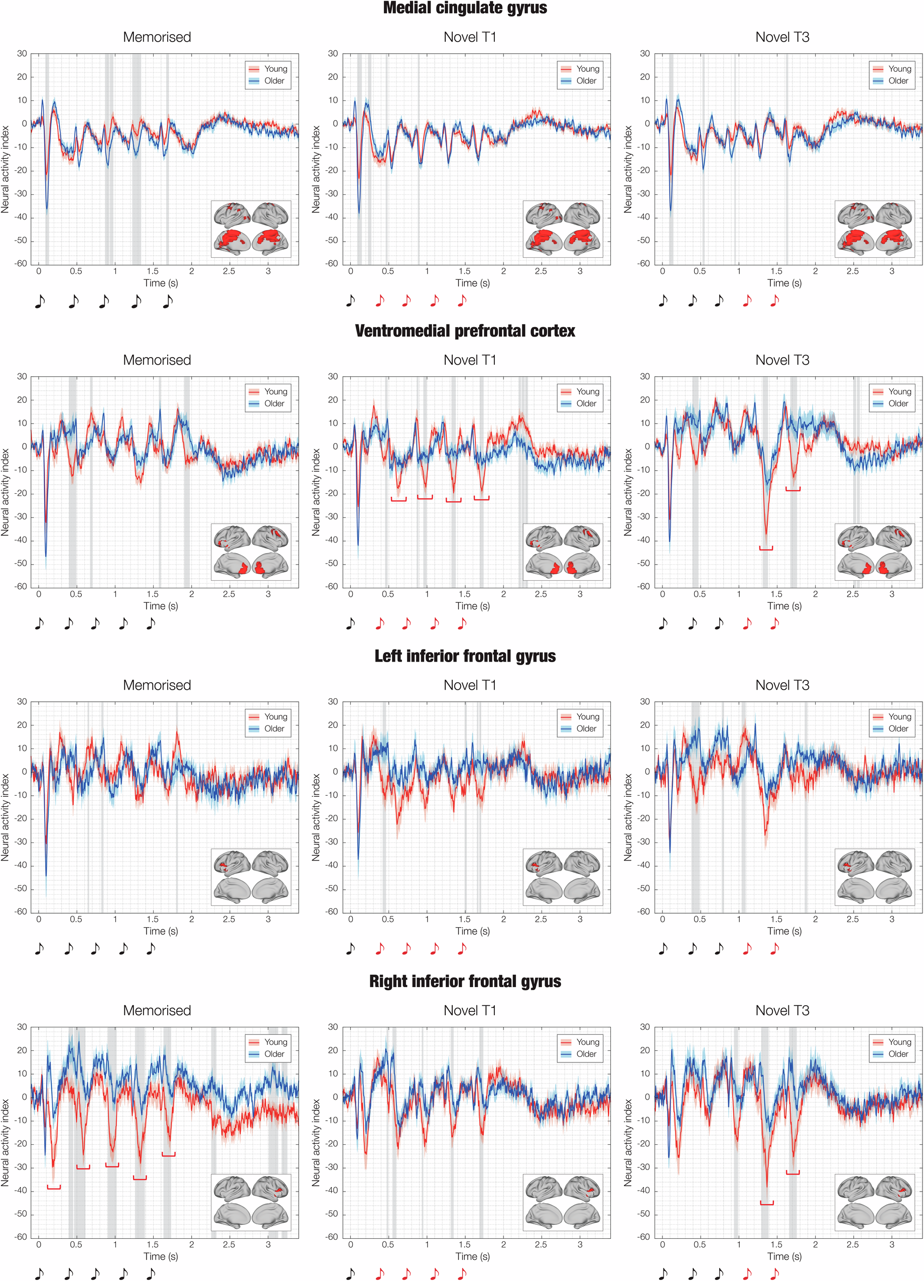Fig. 4: Impact of aging on the cingulate gyrus, ventromedial prefrontal cortex and inferior frontal gyrus responses during recognition of musical sequences.