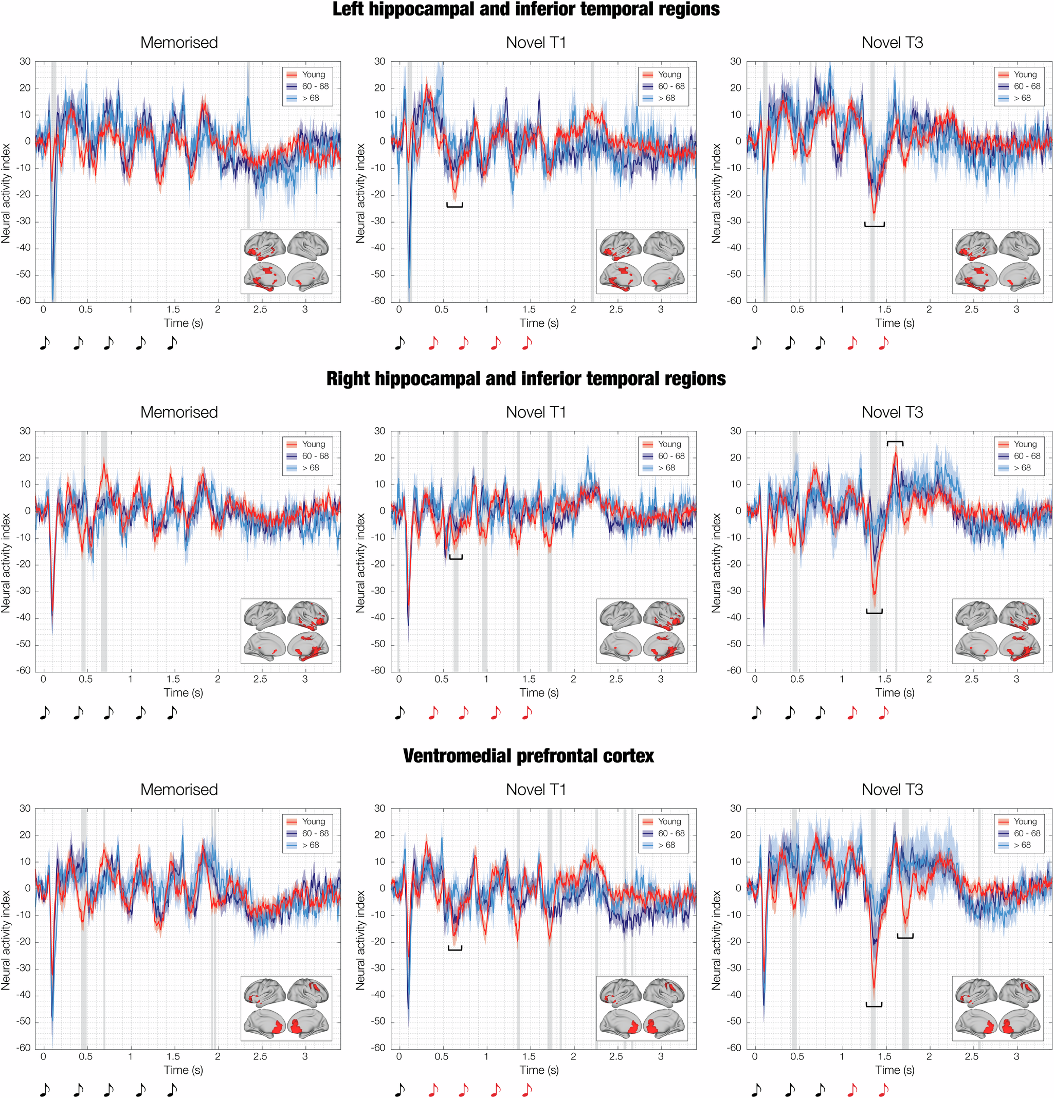 Fig. 6: Ventromedial prefrontal cortex and medial temporal lobe responses during recognition of musical sequences for three age groups (young adults, adults between 60 and 68 years of age, adults older than 68).