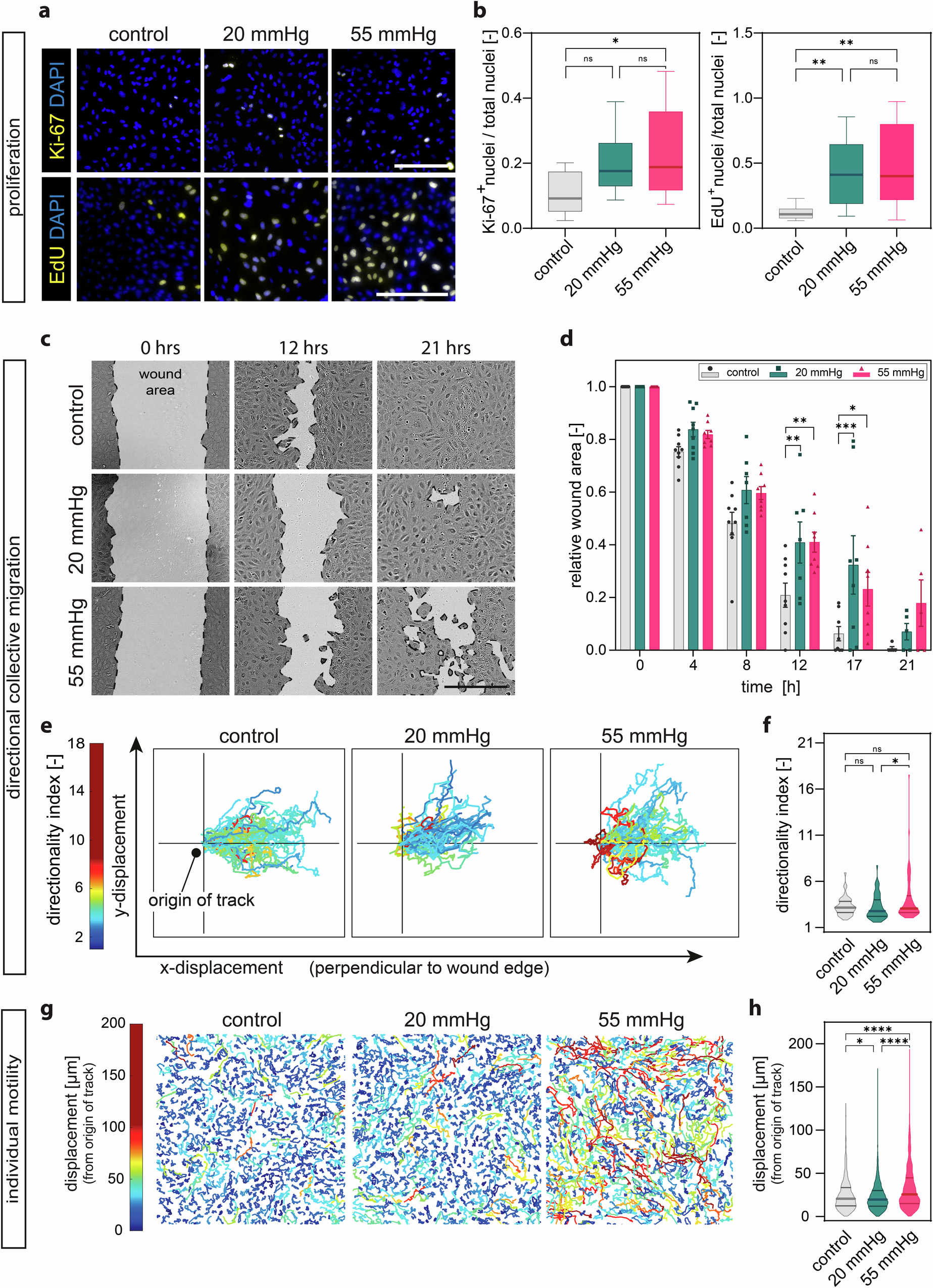 Fig. 3: Proliferation, directional collective migration, and individual motility are modified under microvascular hydrostatic pressure.