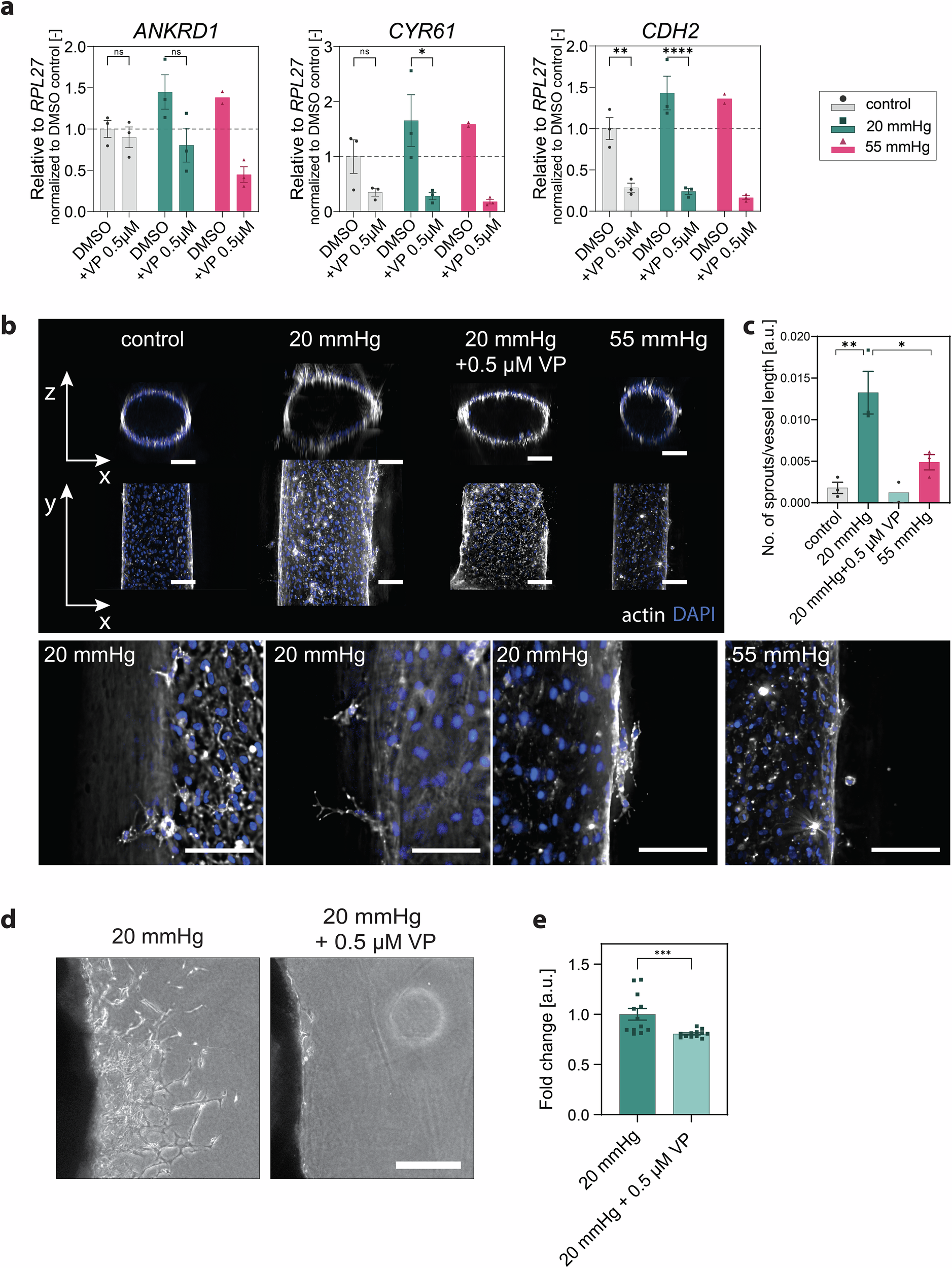 Fig. 8: Hydrostatic pressure stimulation promotes sprouting angiogenesis through YAP activity.