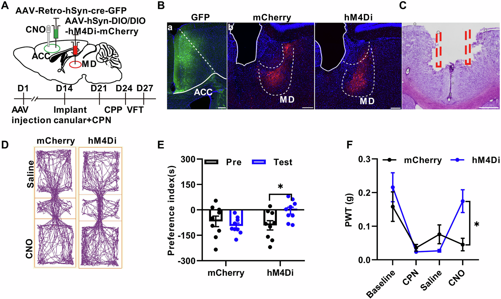Fig. 8: The inhibition of MD-ACC pathway relieved mechanical pain and produced conditioned place preference (CPP) after nerve injury.